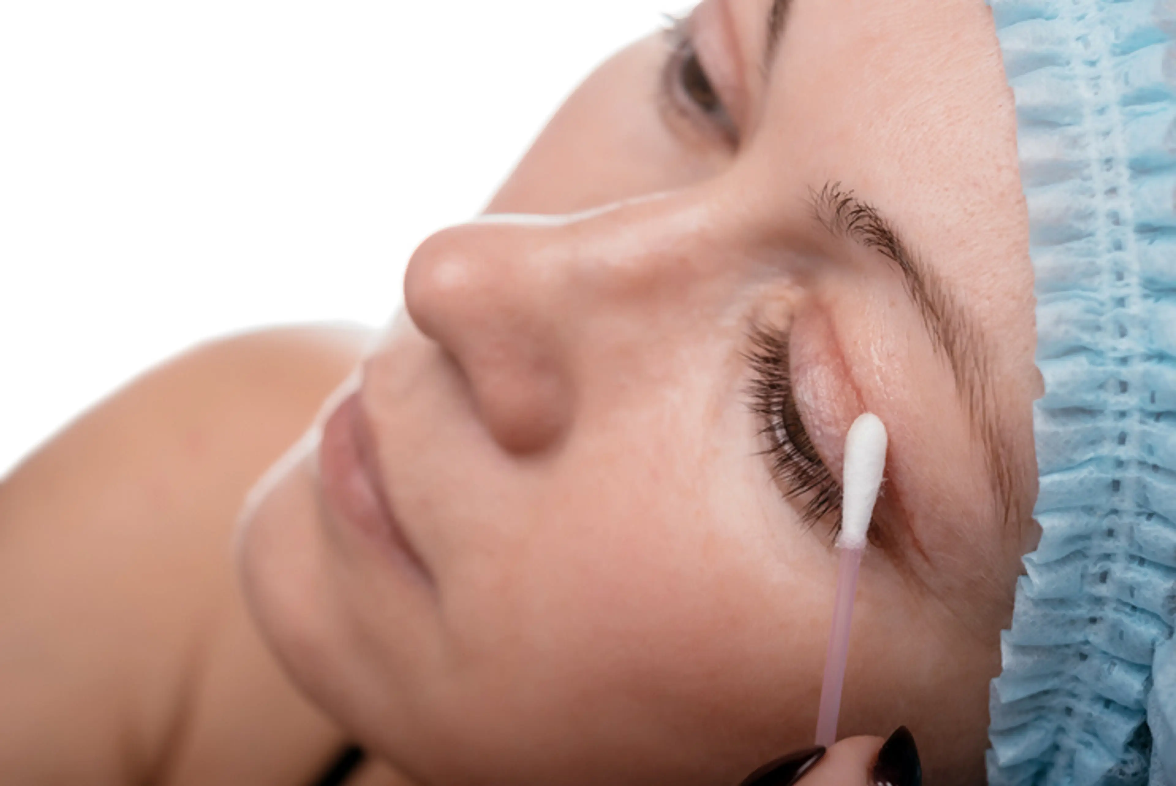 Eyelid Surgery