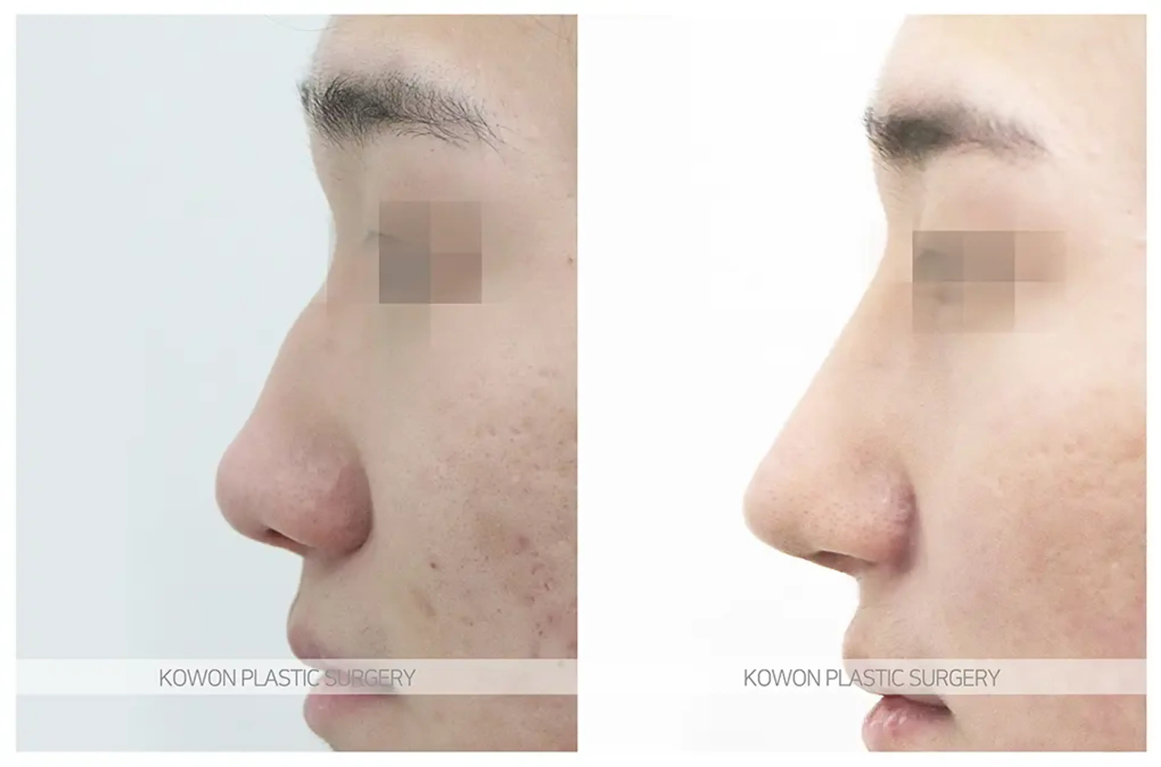 Kowon Plastic Surgery