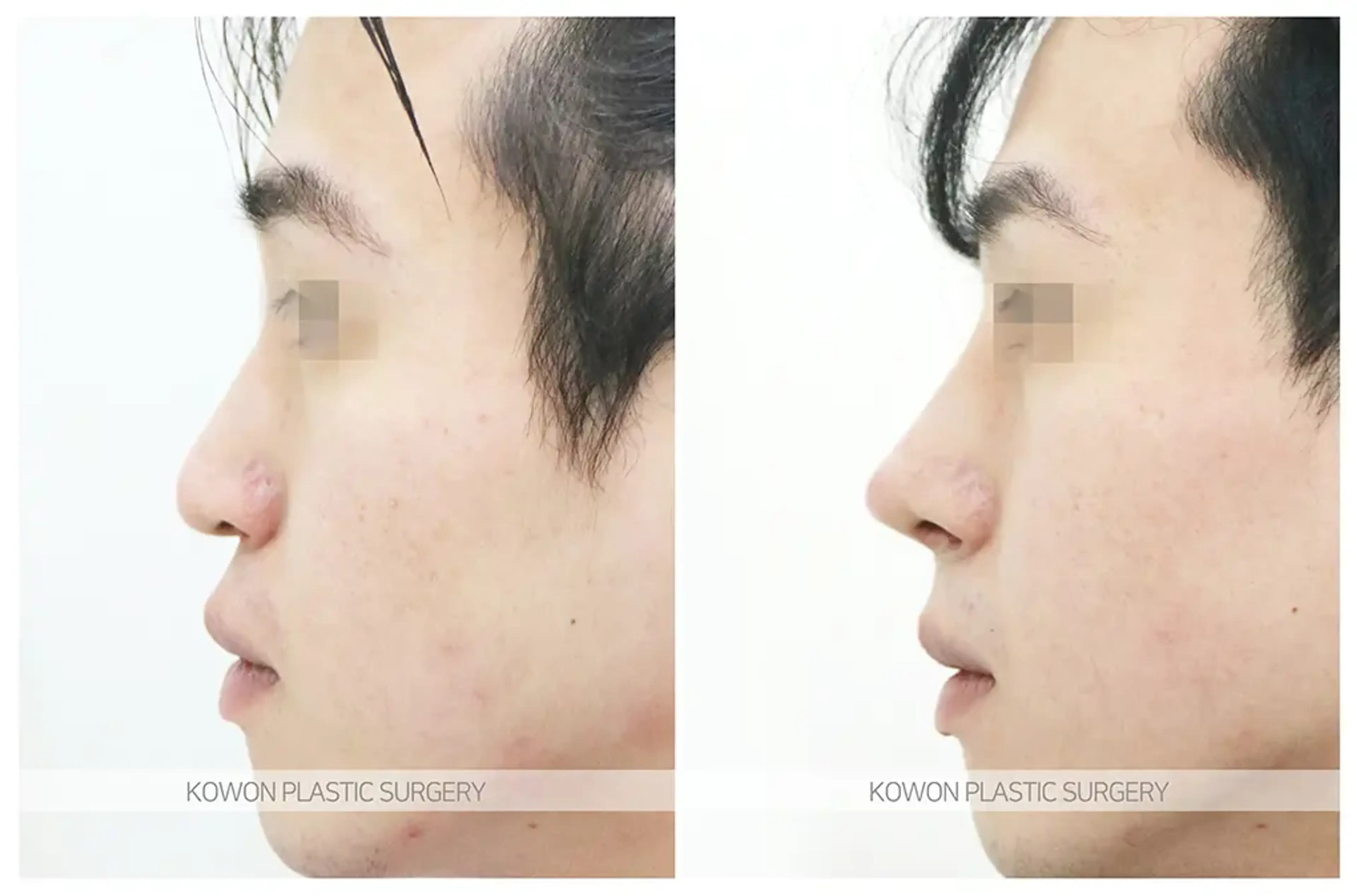 Kowon Plastic Surgery