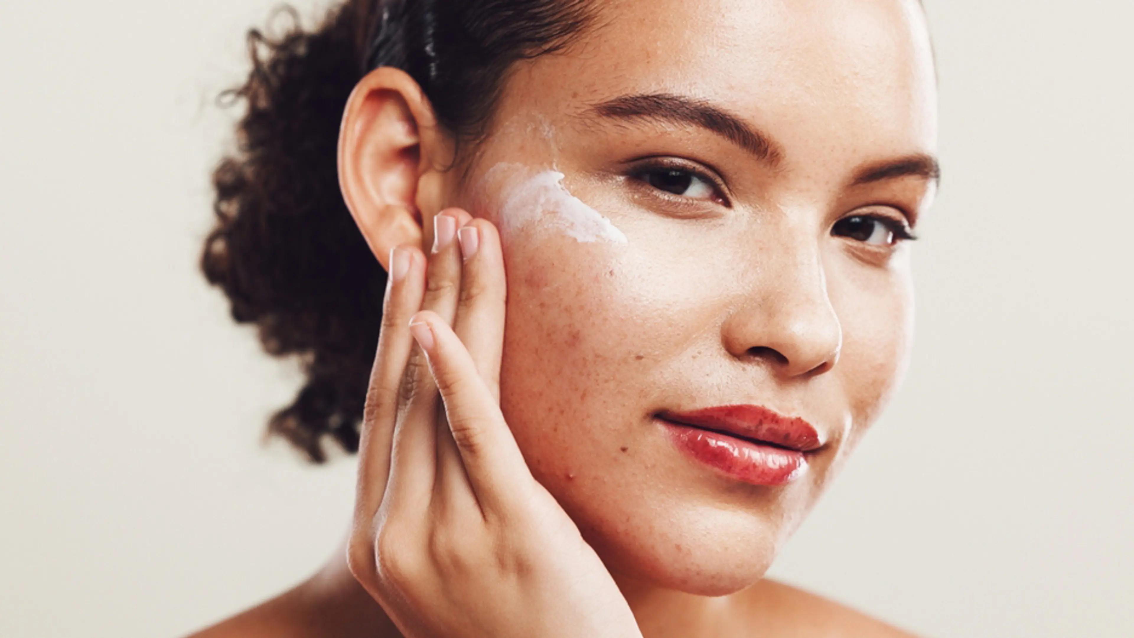 Hyperpigmentation