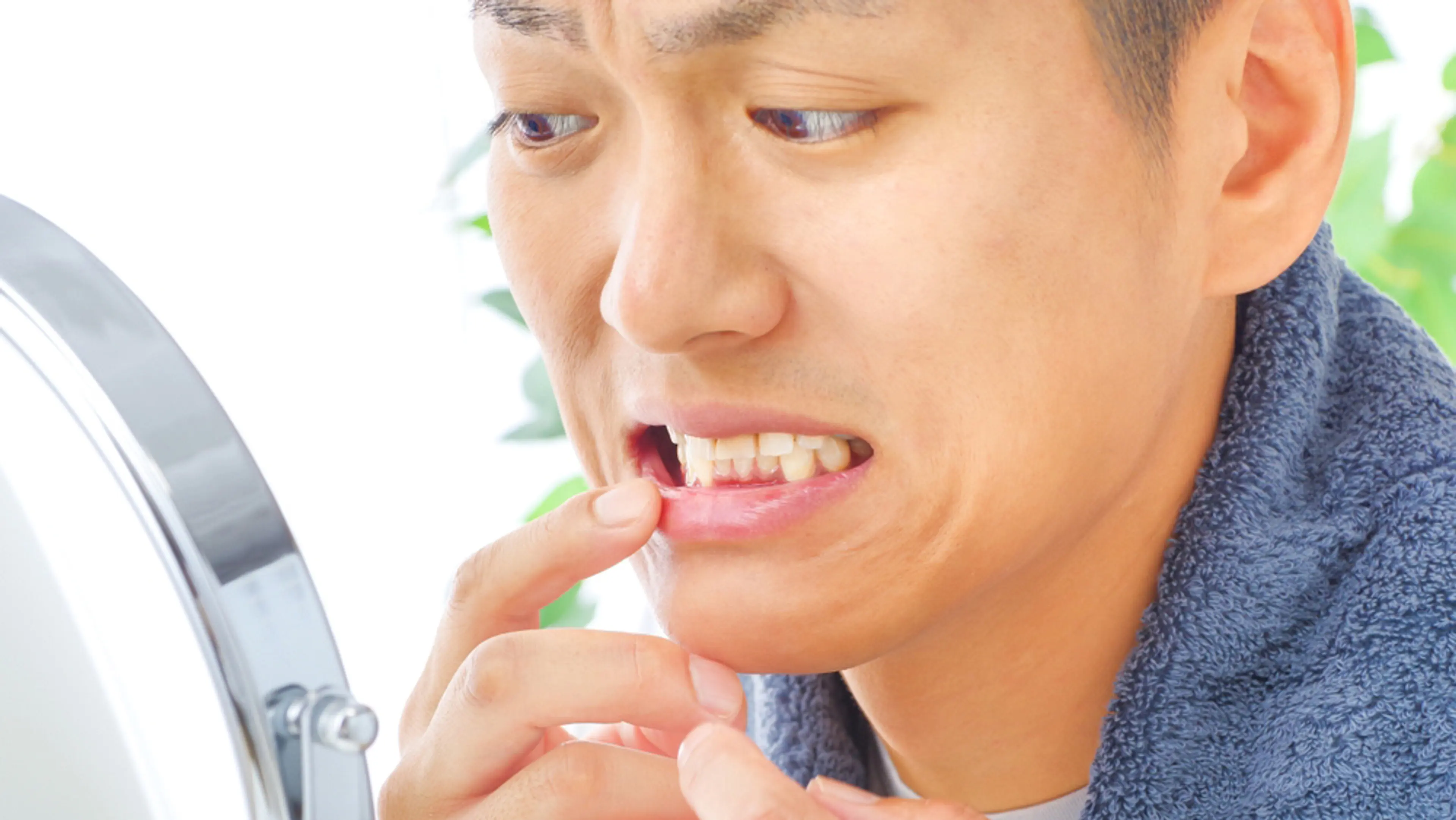 Uneven Whitening