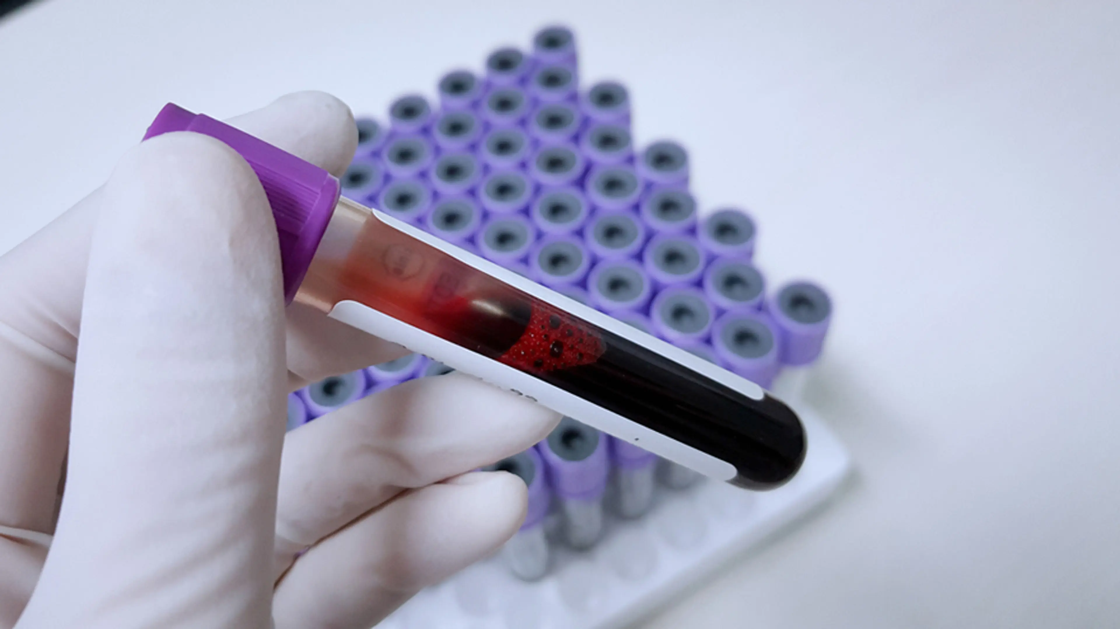 Blood Test