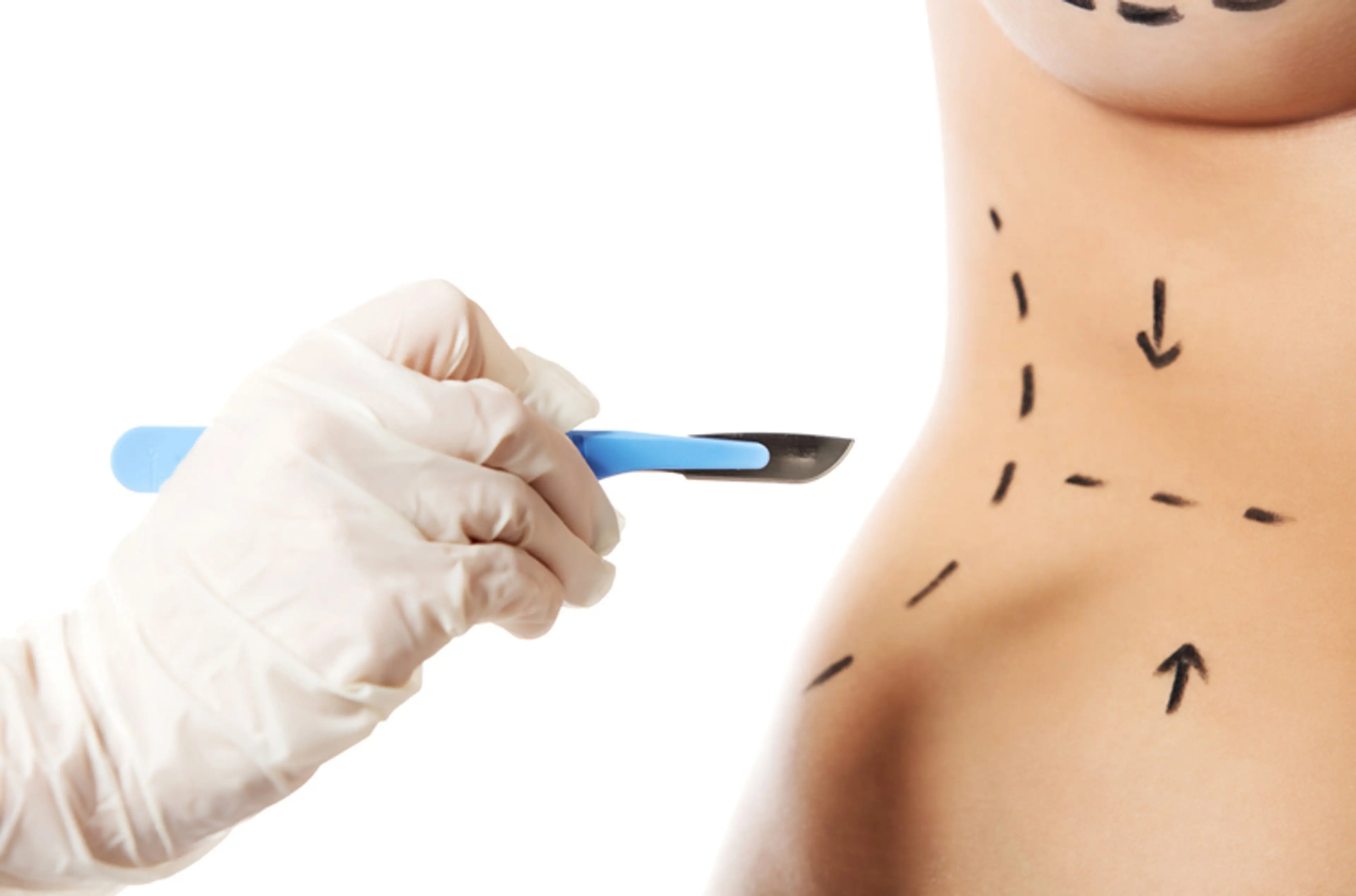 body contouring