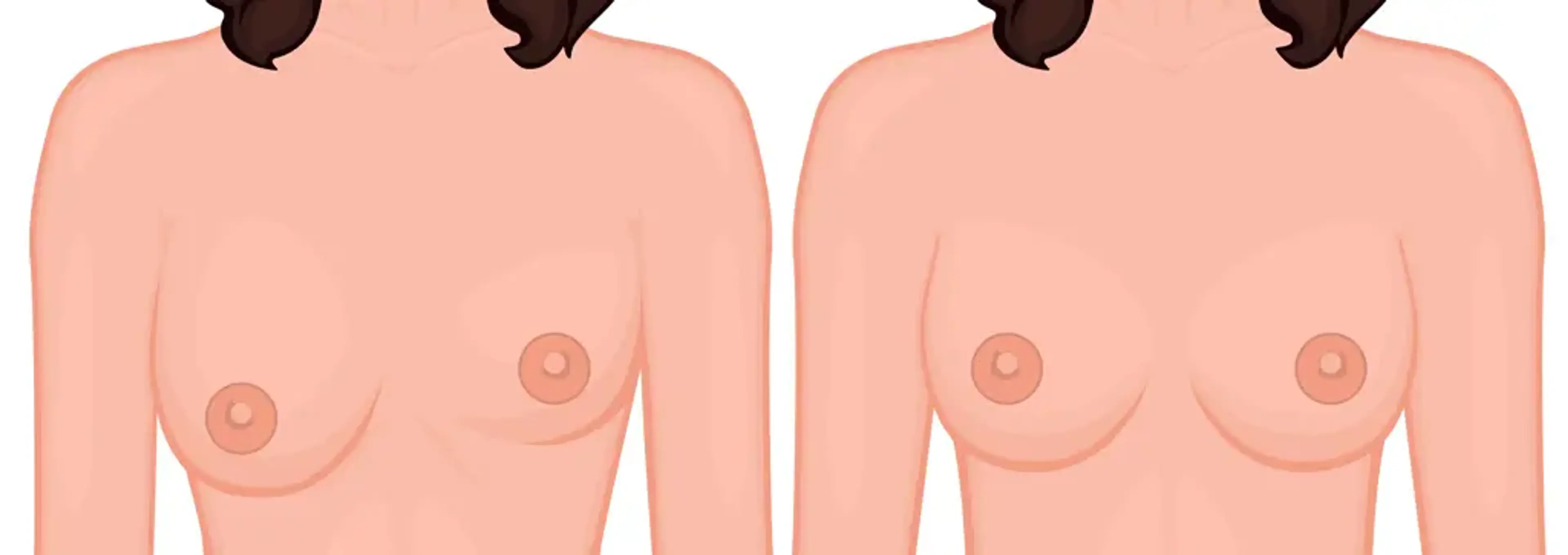 Human Plastic Surgery