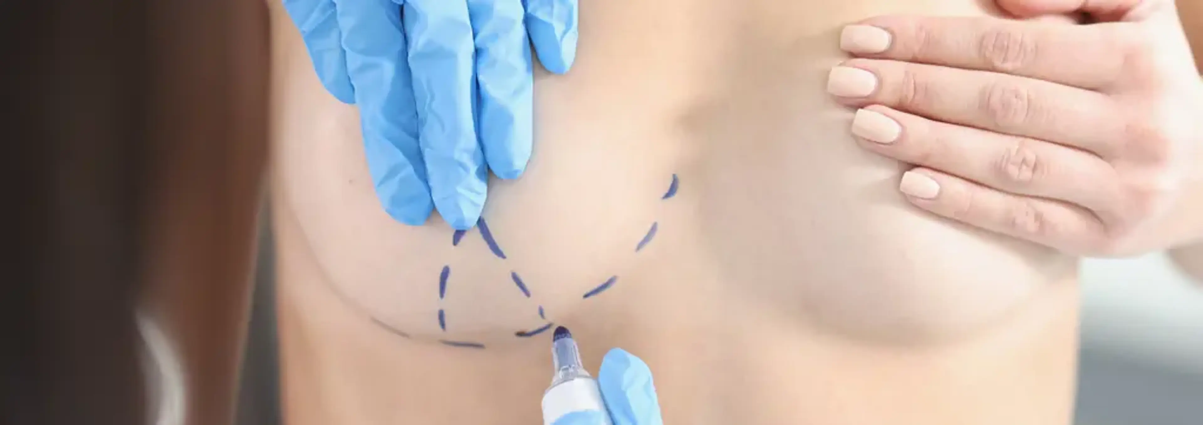 Human Plastic Surgery