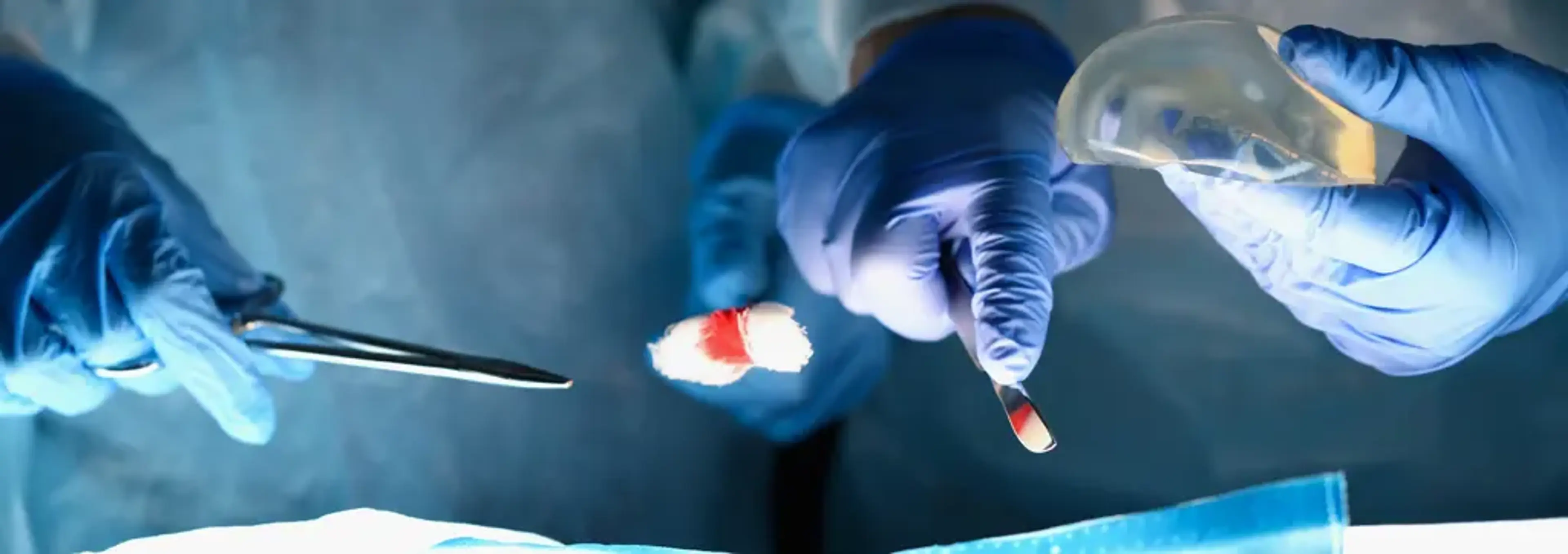 Human Plastic Surgery