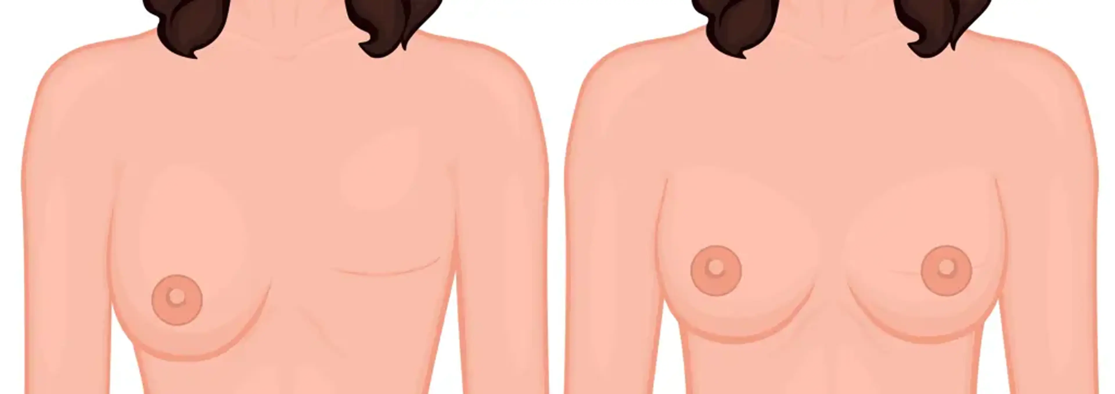 Human Plastic Surgery