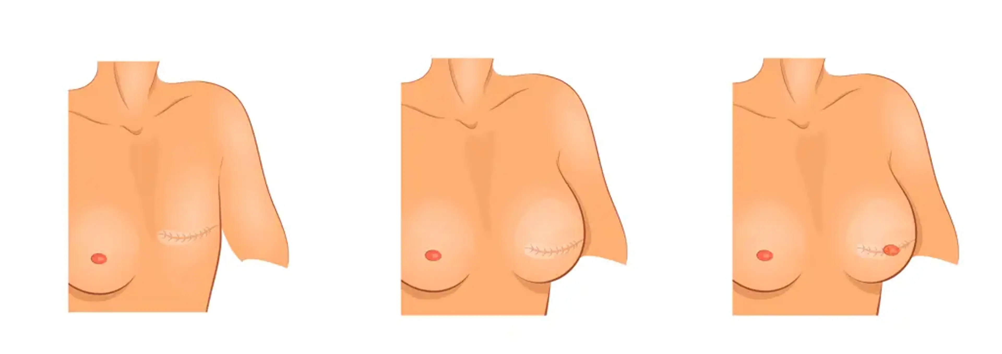 Human Plastic Surgery