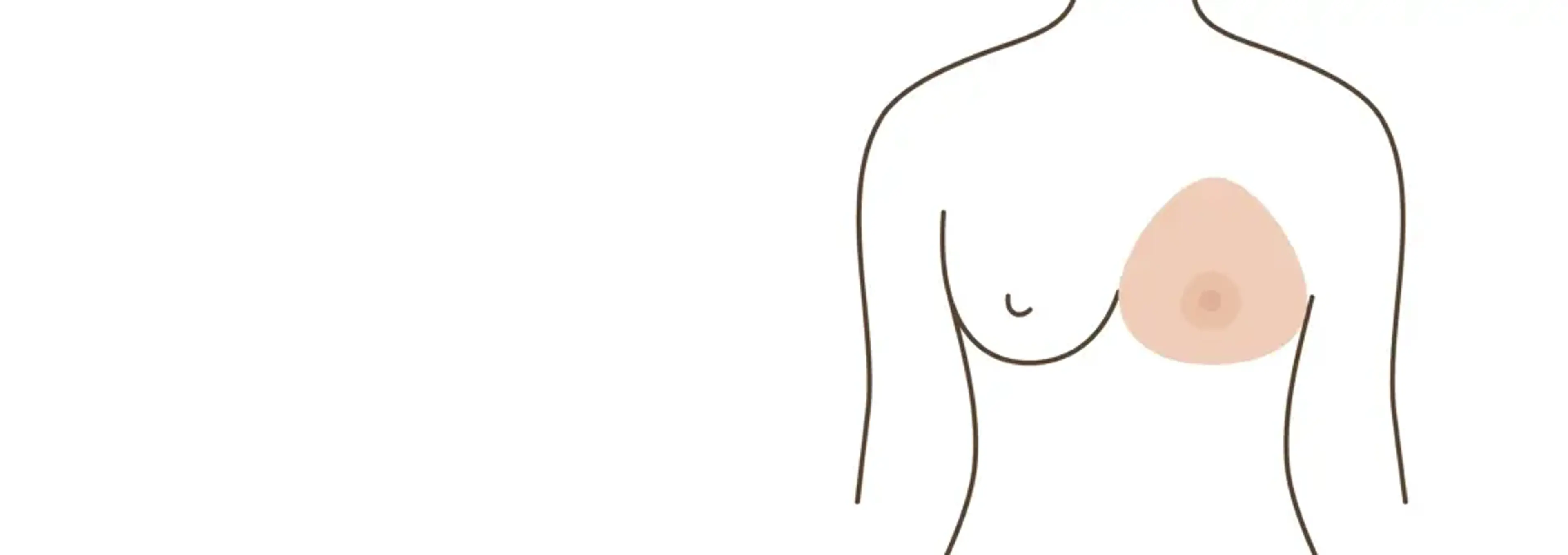 Human Plastic Surgery