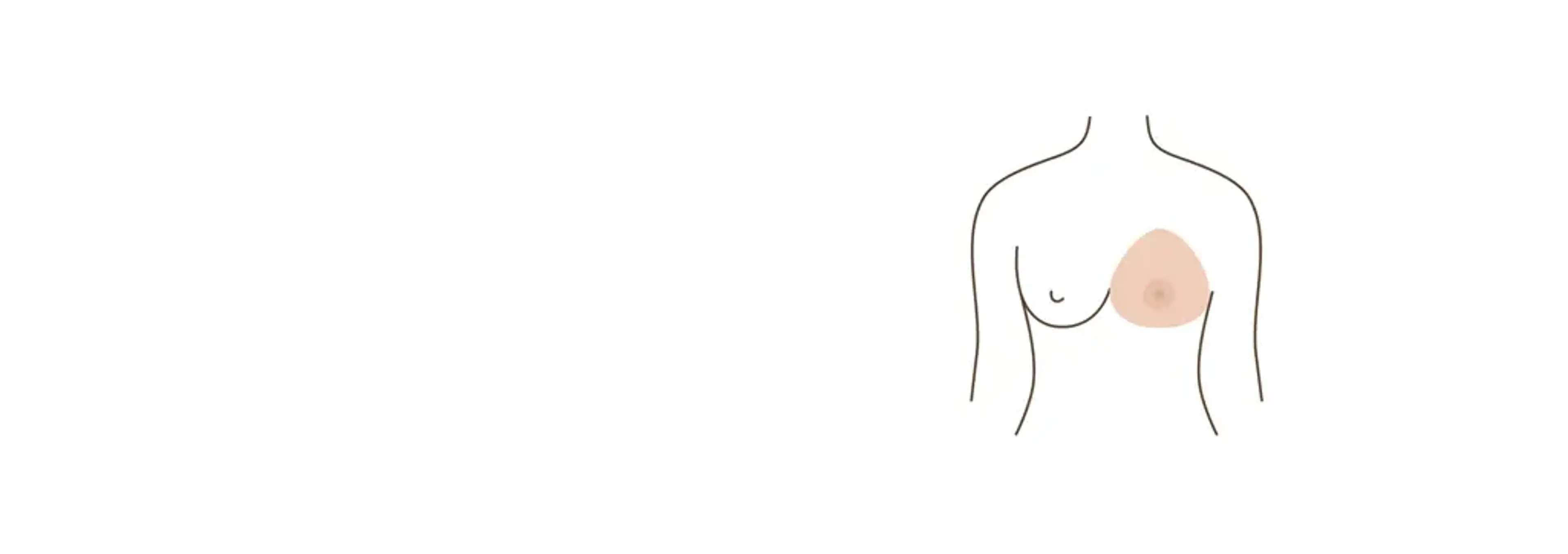 Human Plastic Surgery