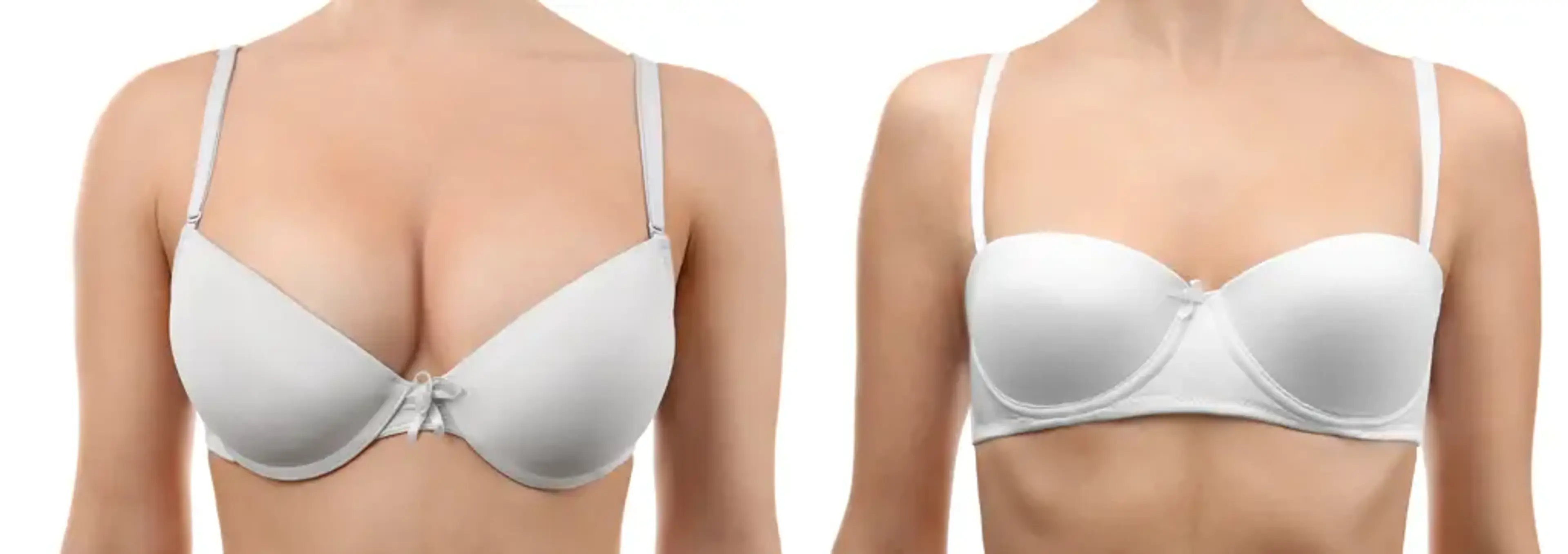 Human Plastic Surgery