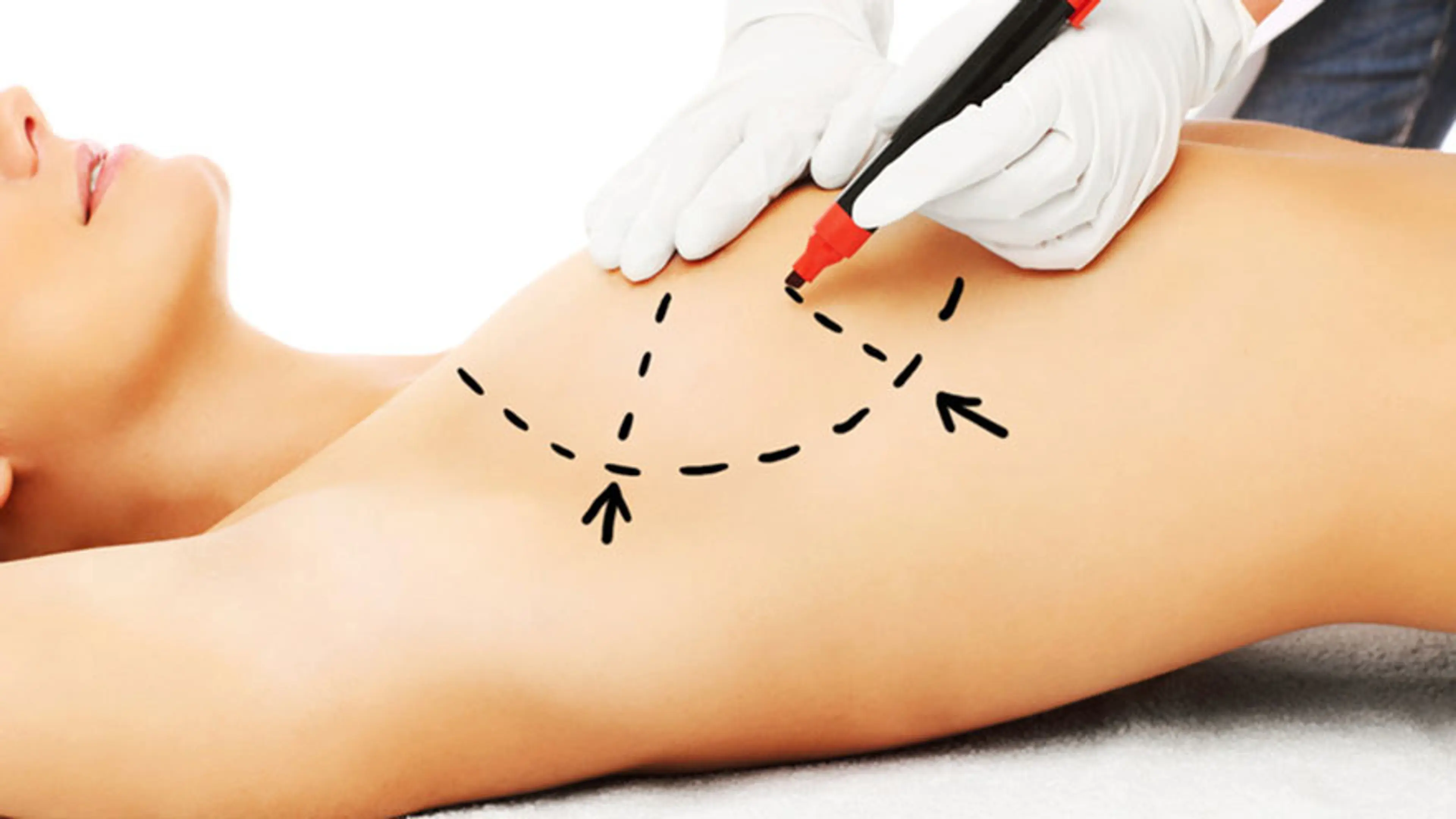 脂肪移植可使您的乳房焕发青春