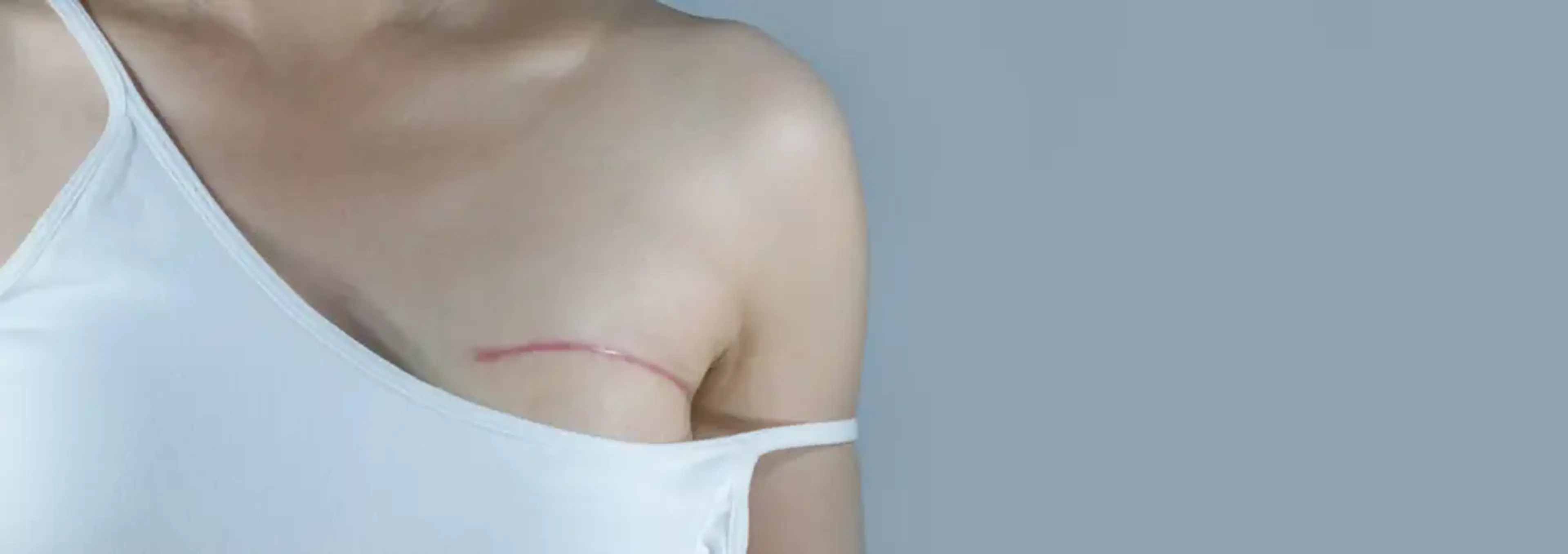 Human Plastic Surgery