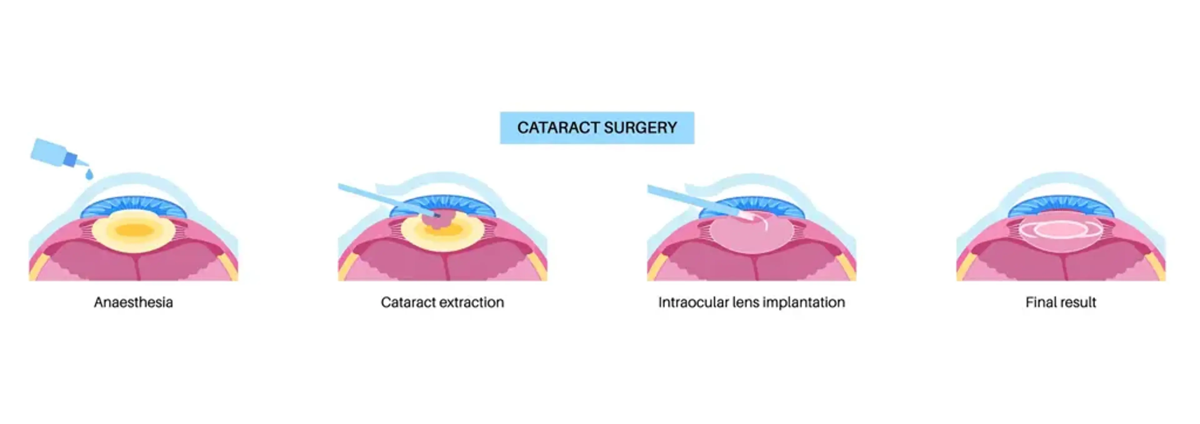 Gangnam Joeunnun Vision Clinic