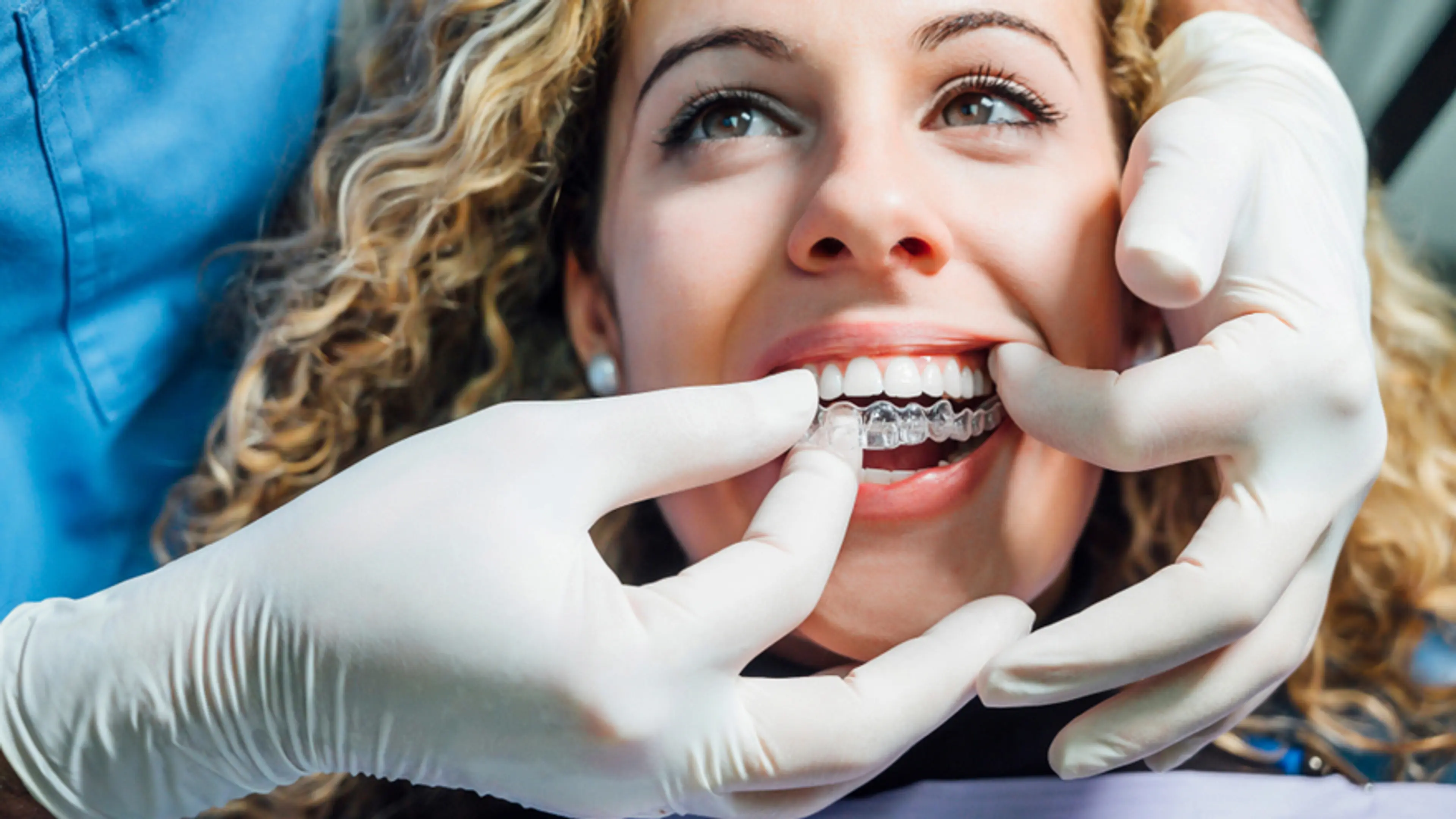 What Are Clear Braces?