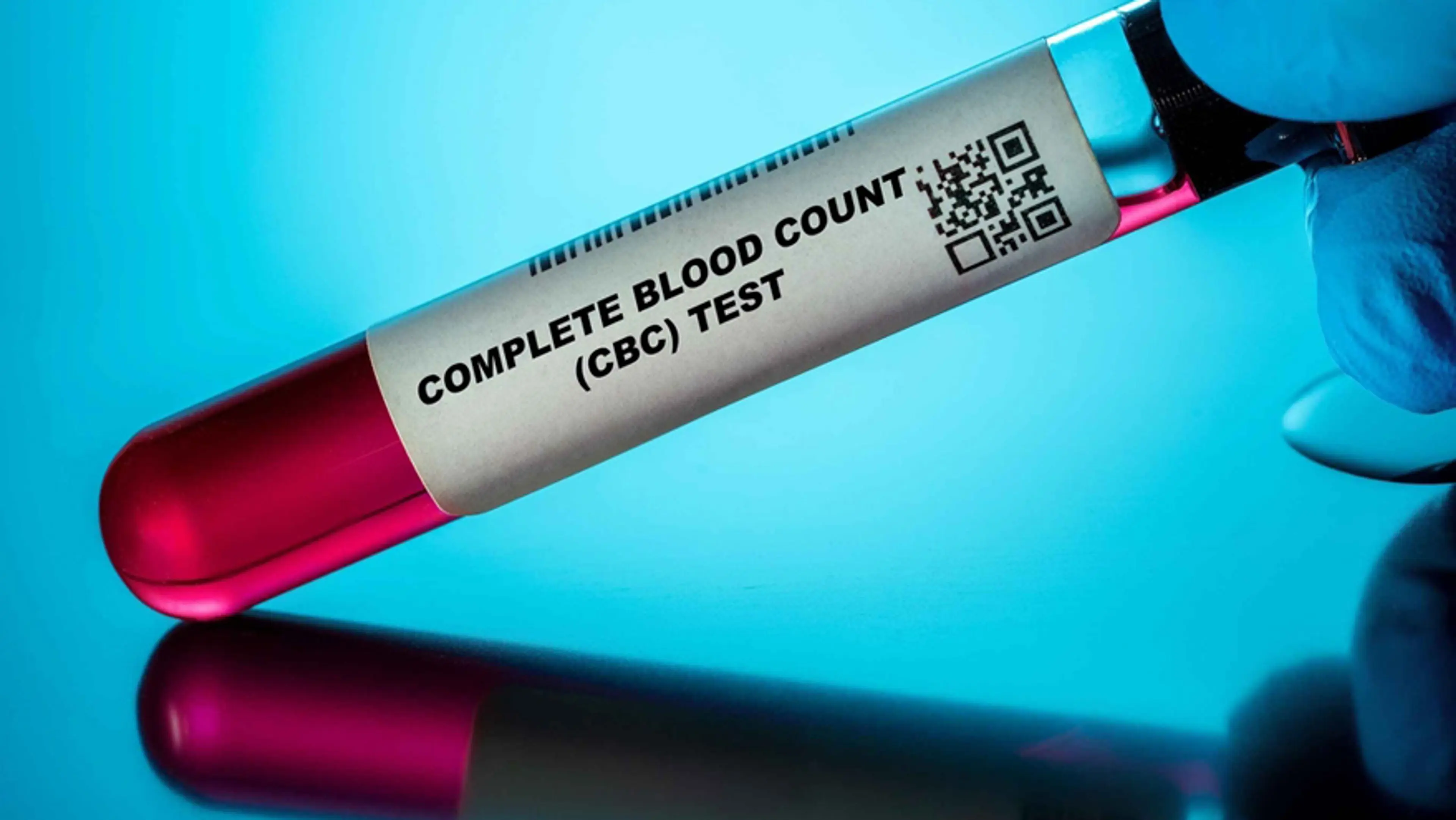 Complete Blood Count