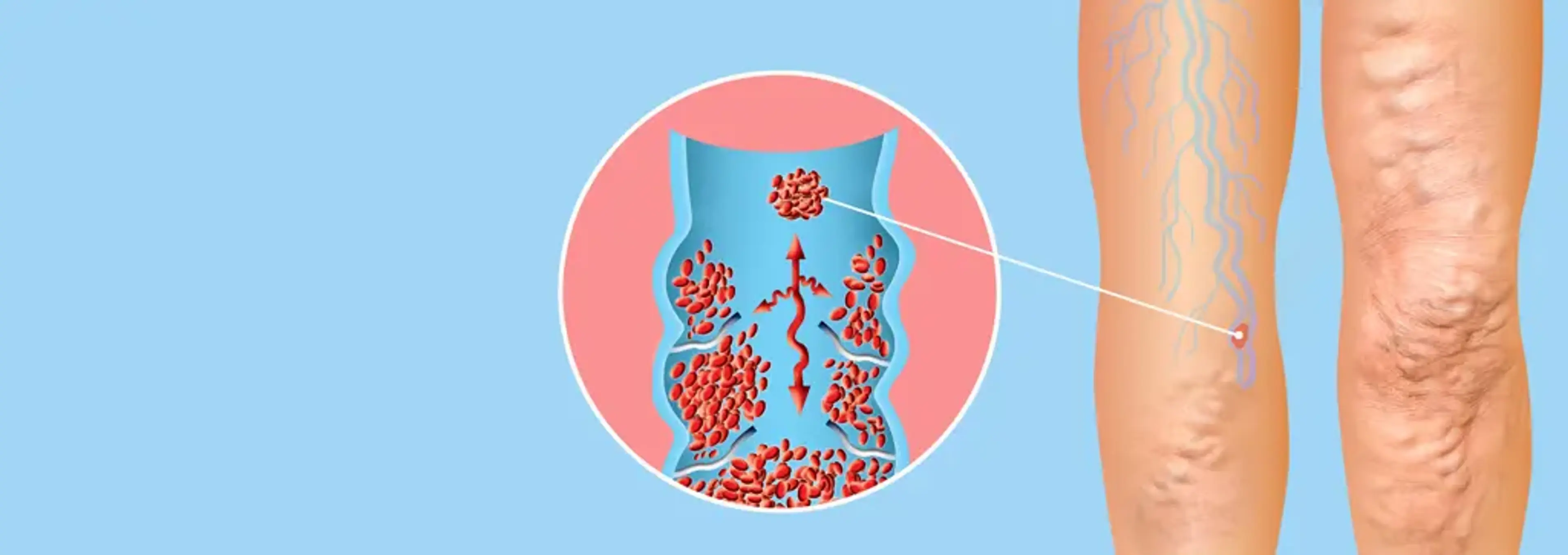 Charm Vascular Clinic