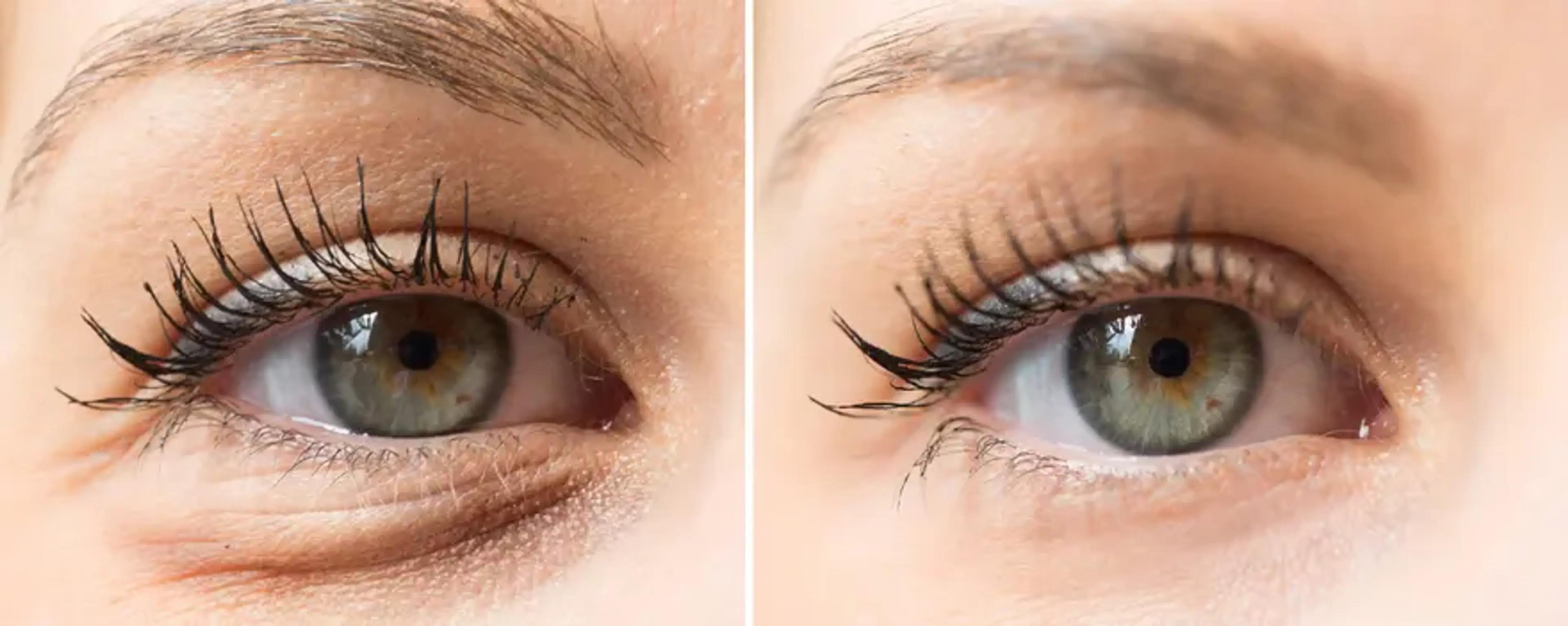 1mm Plastic Surgery