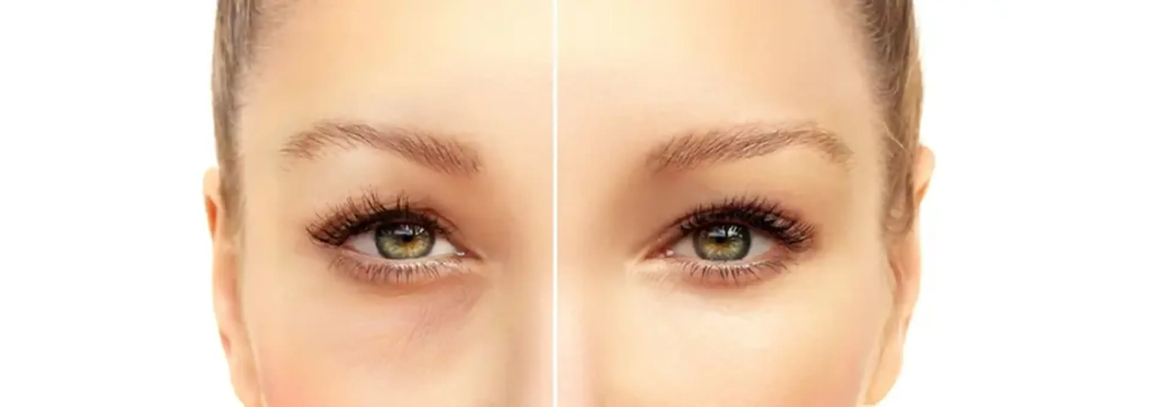 Gangnamseoyon Plastic Surgery