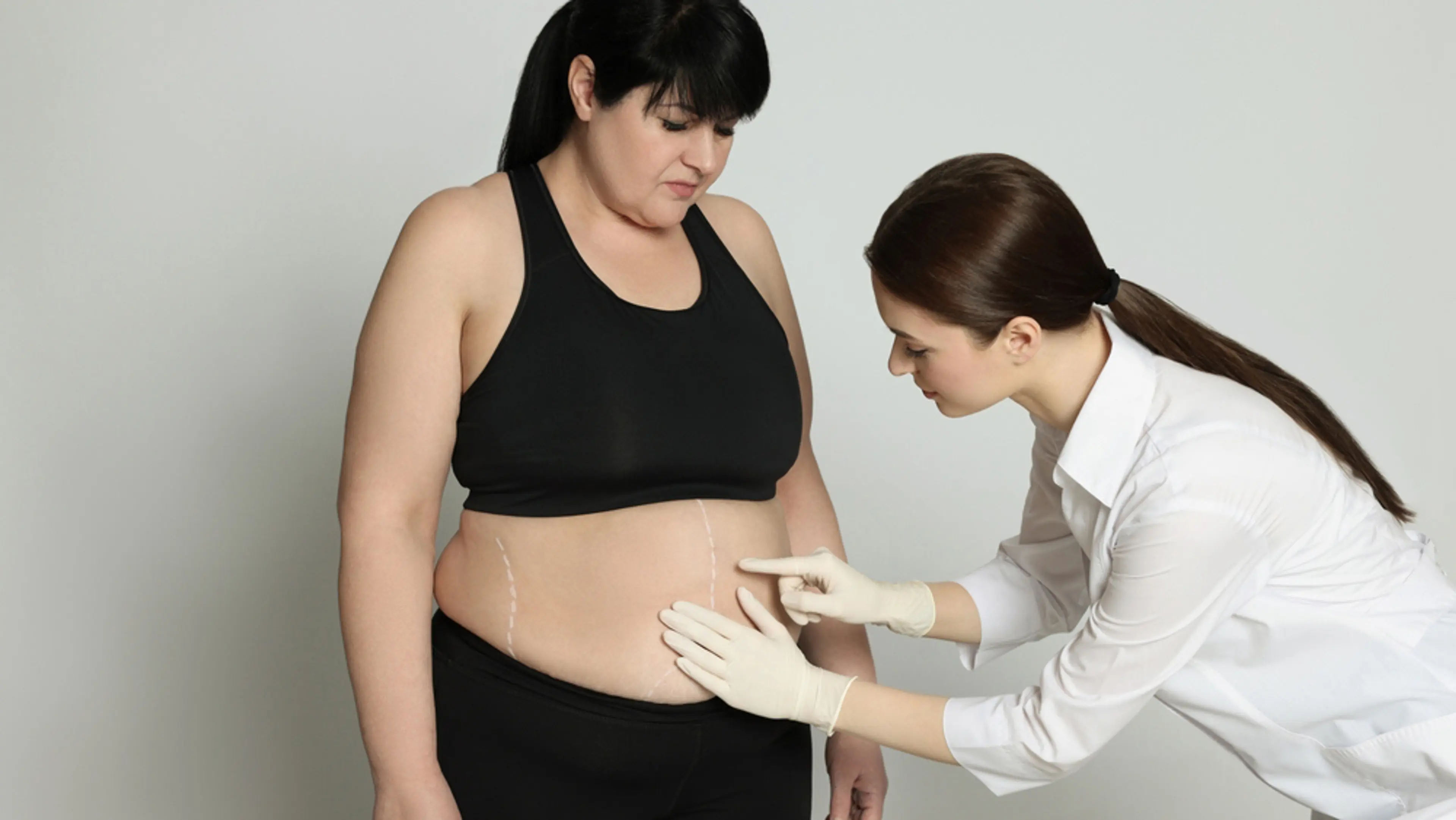 Fat Removal