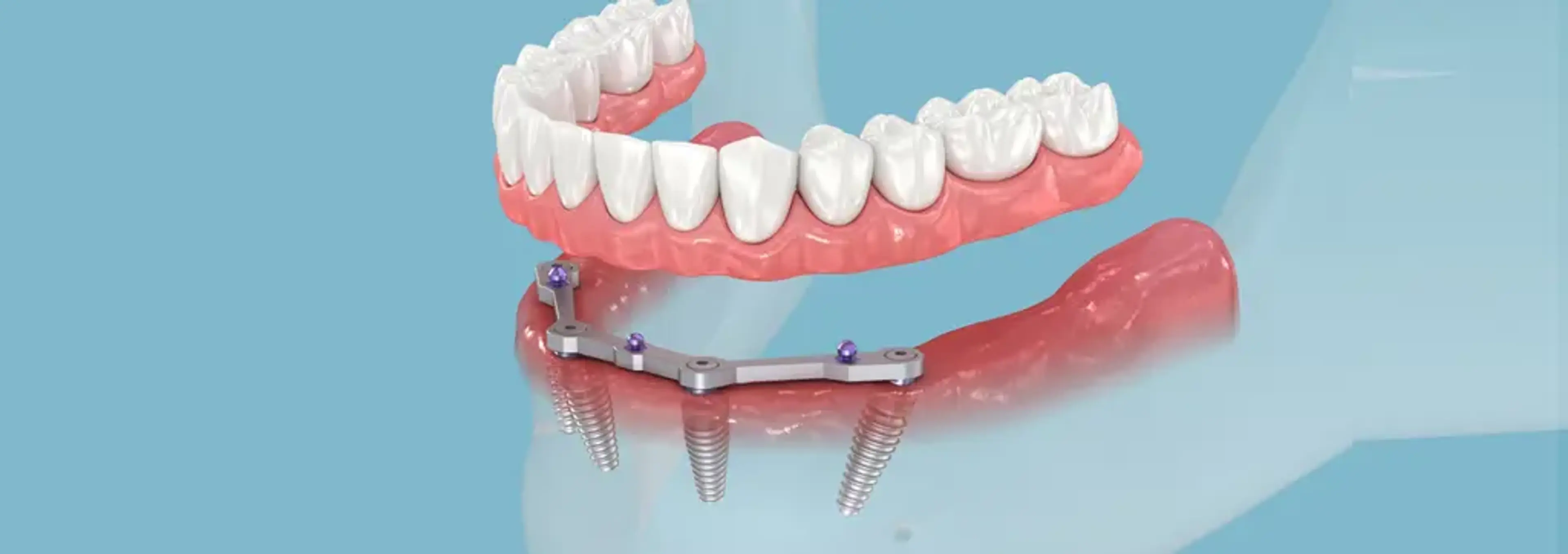 Ye-On Dental Clinic