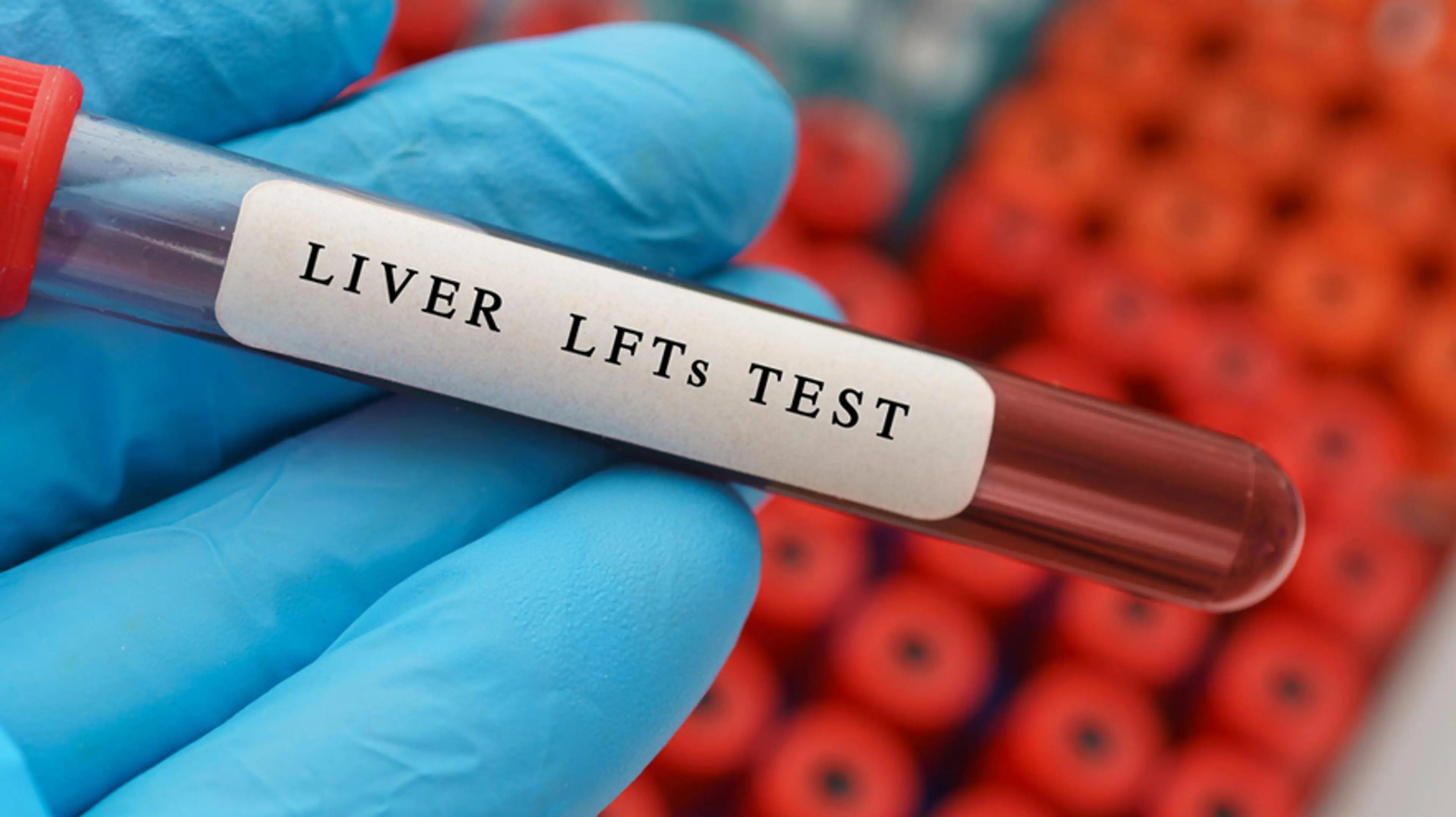 Liver Function Tests