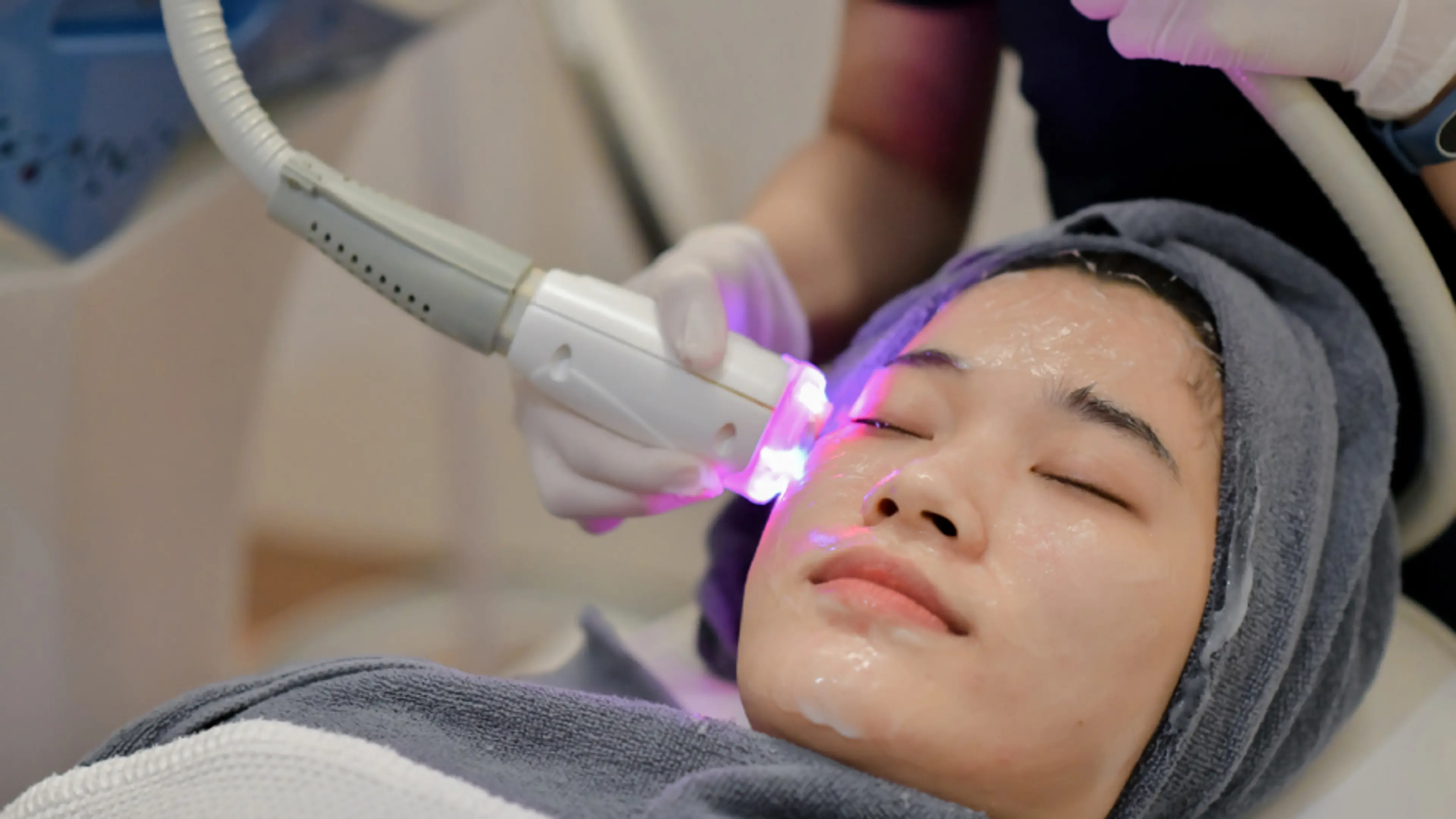 여드름 흉터를 위한 최고의 레이저 치료