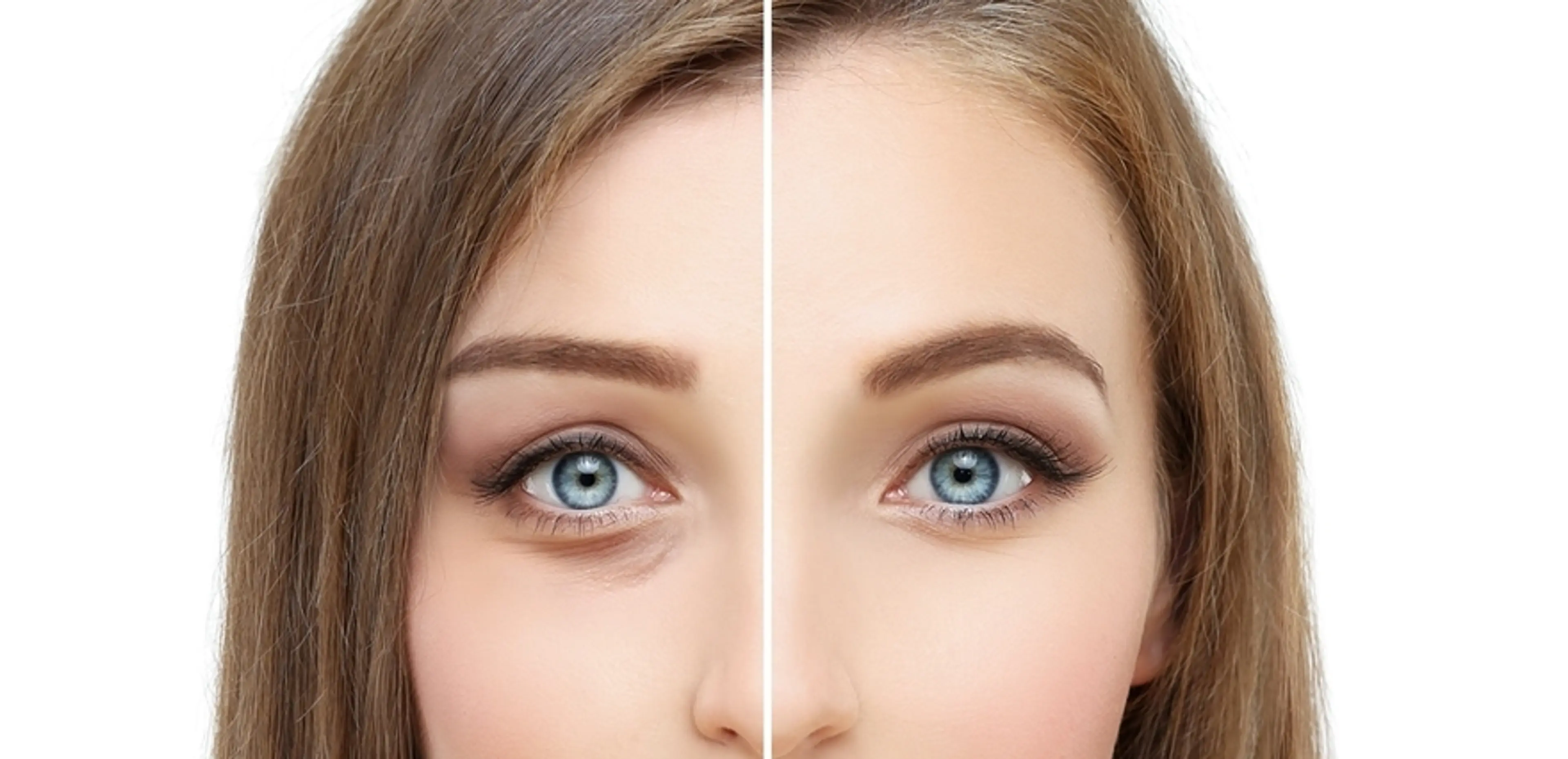 上睑与下睑手术