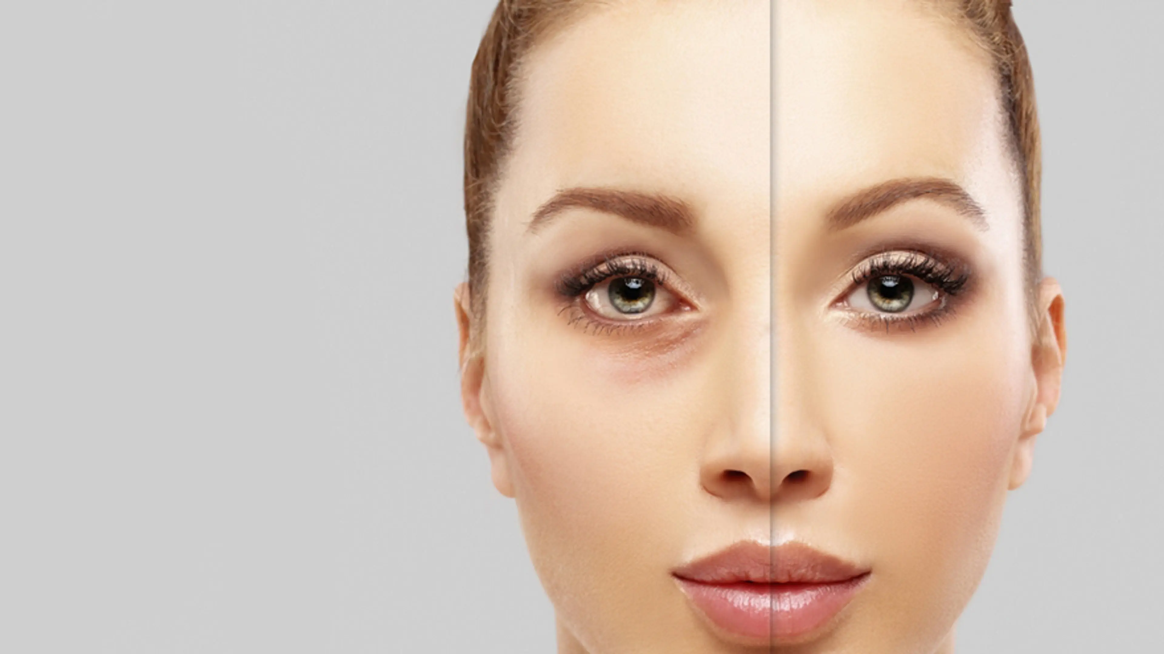 Липофилинг лица