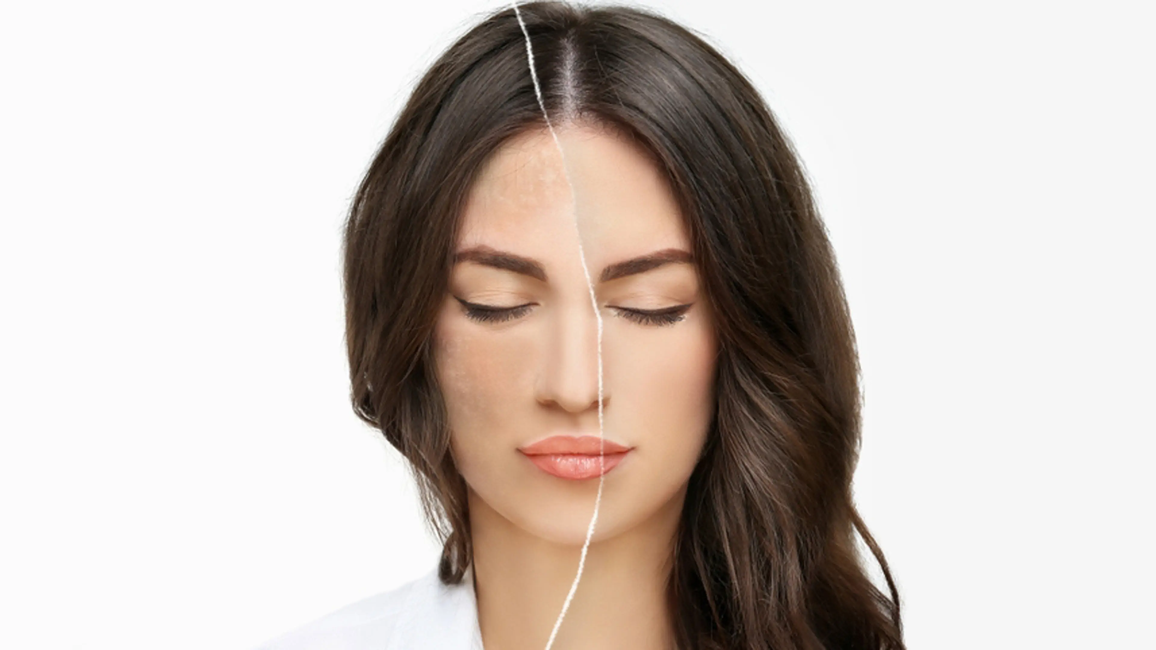 Pigmentation After Pregnancy
