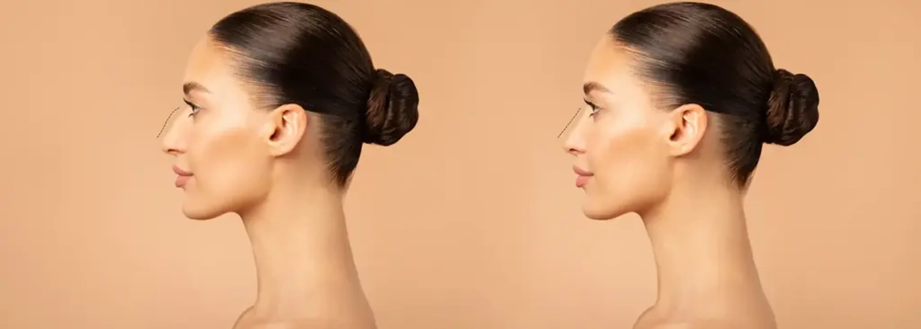 Kowon Plastic Surgery