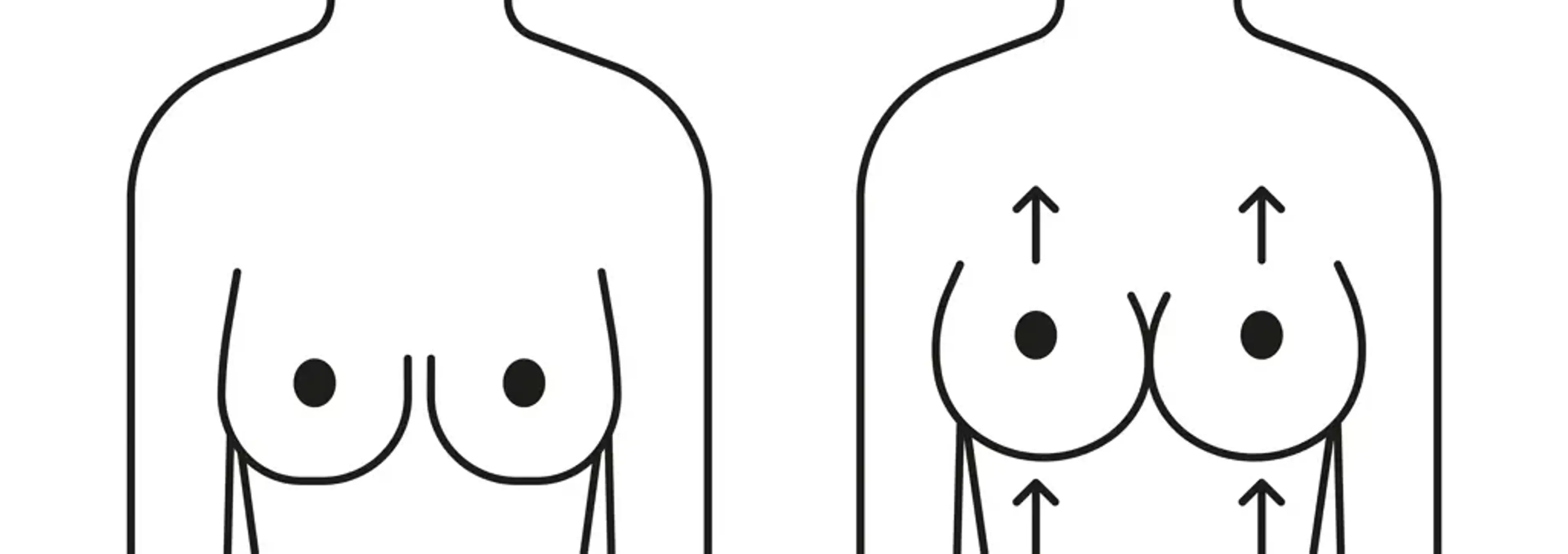 Human Plastic Surgery