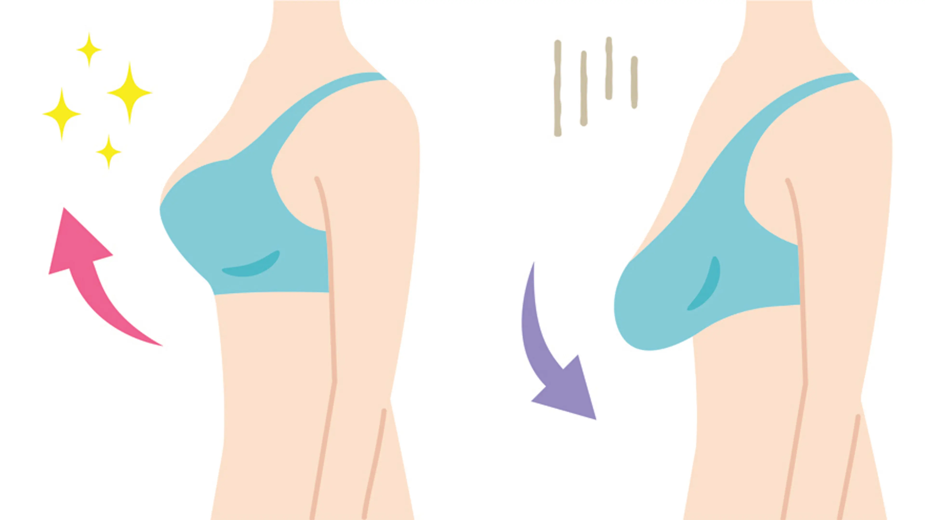 乳房下垂