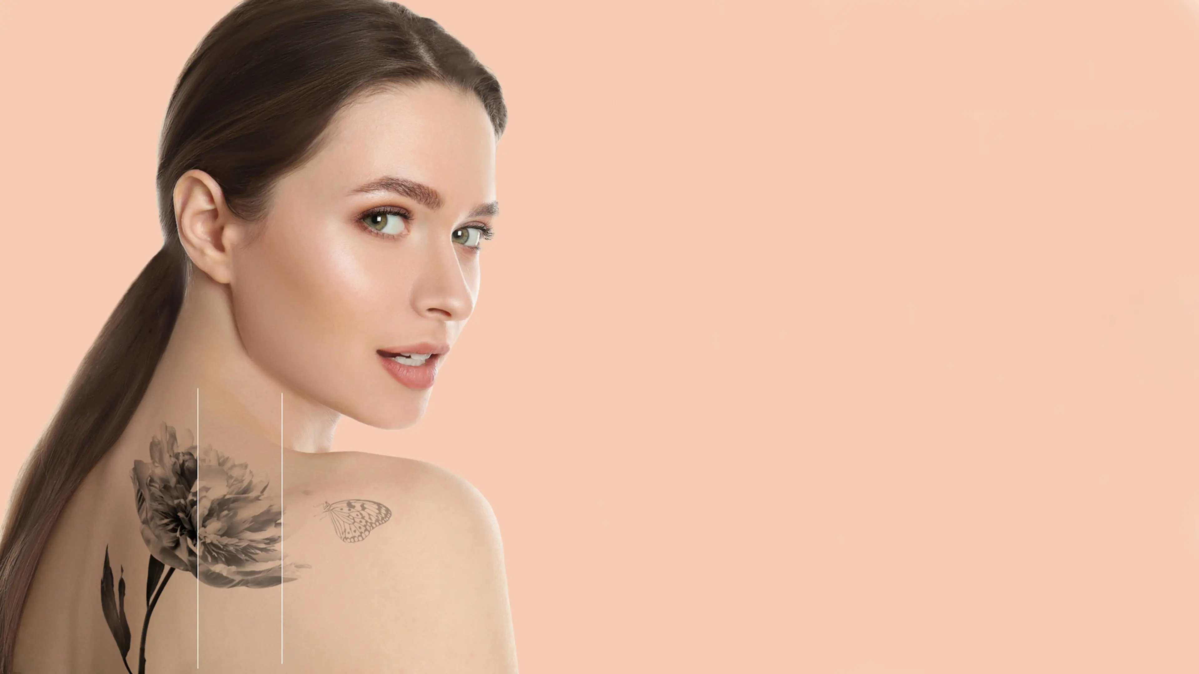 Tattoo Removal