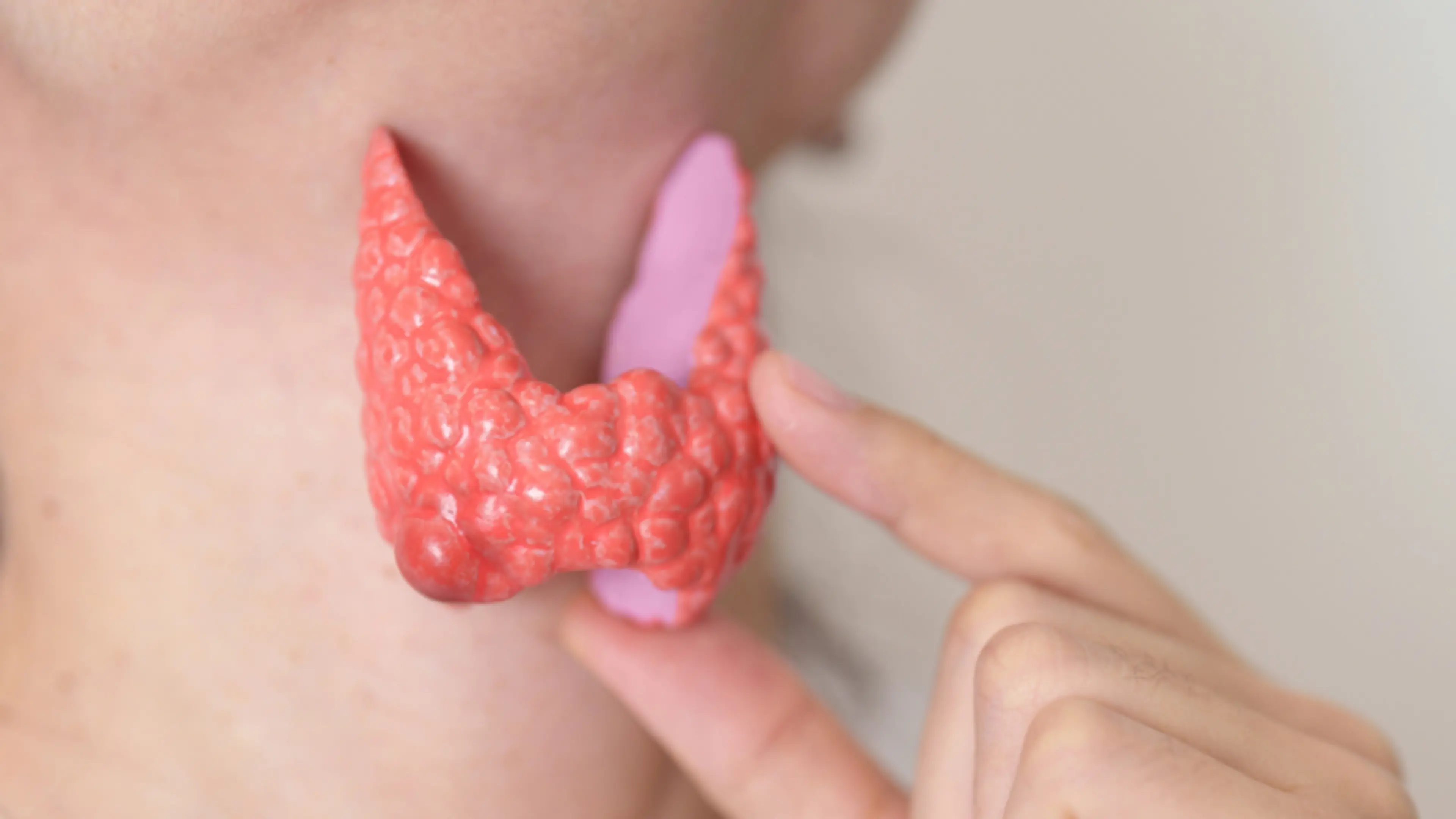 tonsilloliths - Tonsil Stones