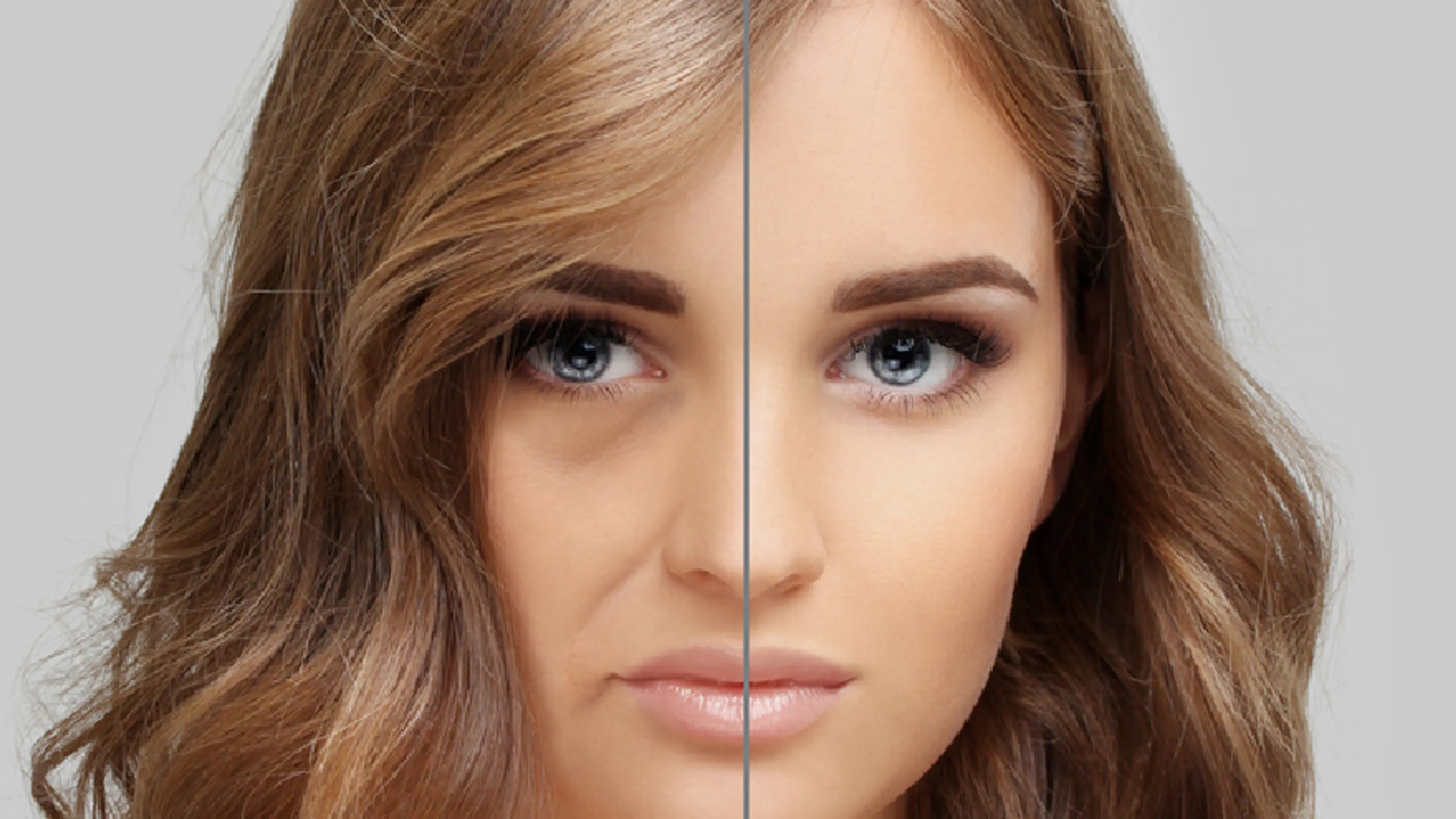 Upper Eyelid Fat Removal