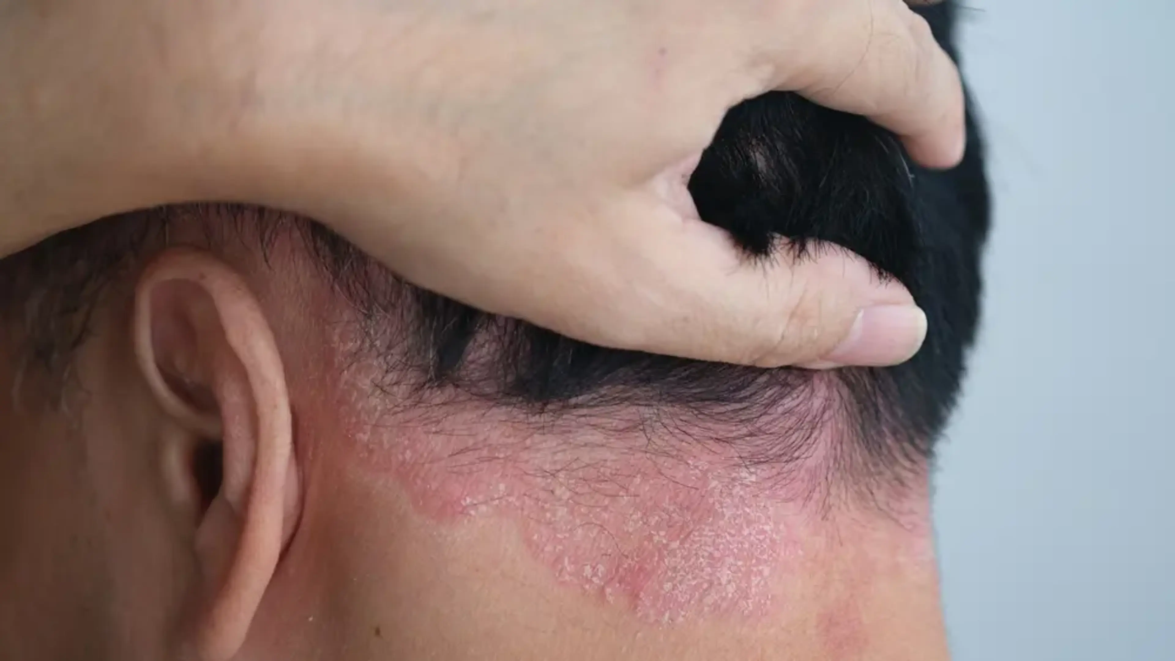Medical Dermatology
