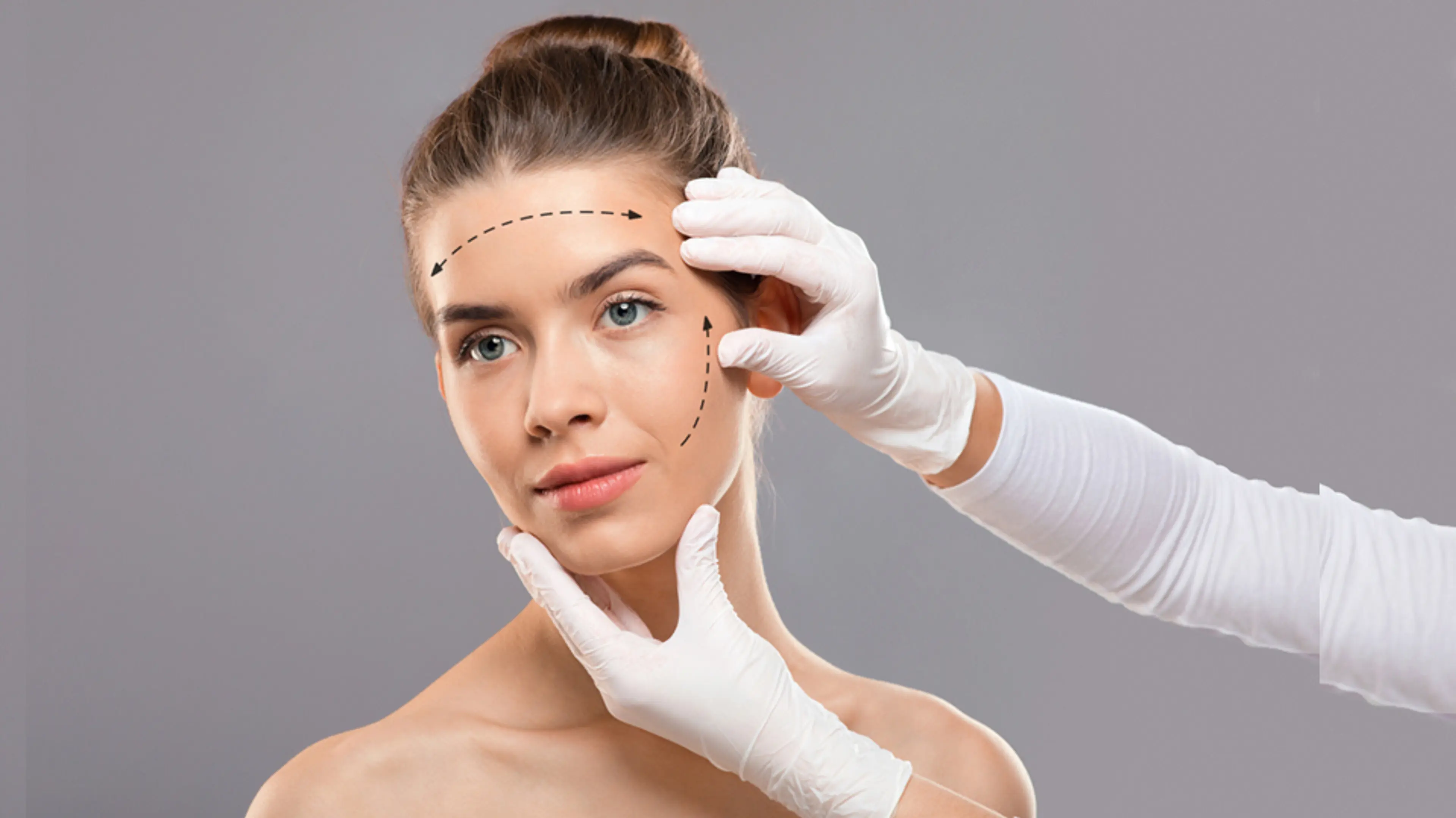 传统面部提升术