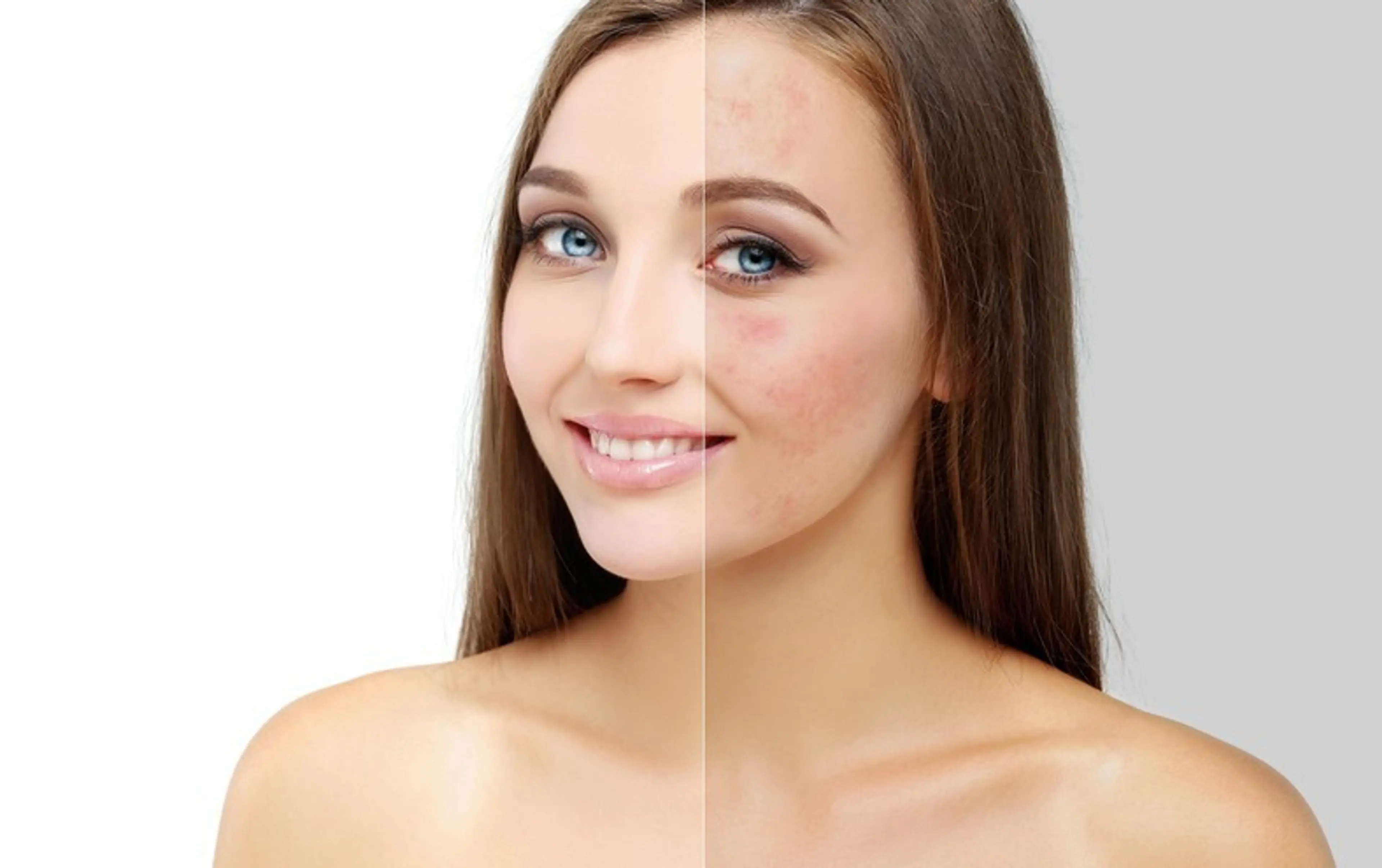 Science of Skin Brightening