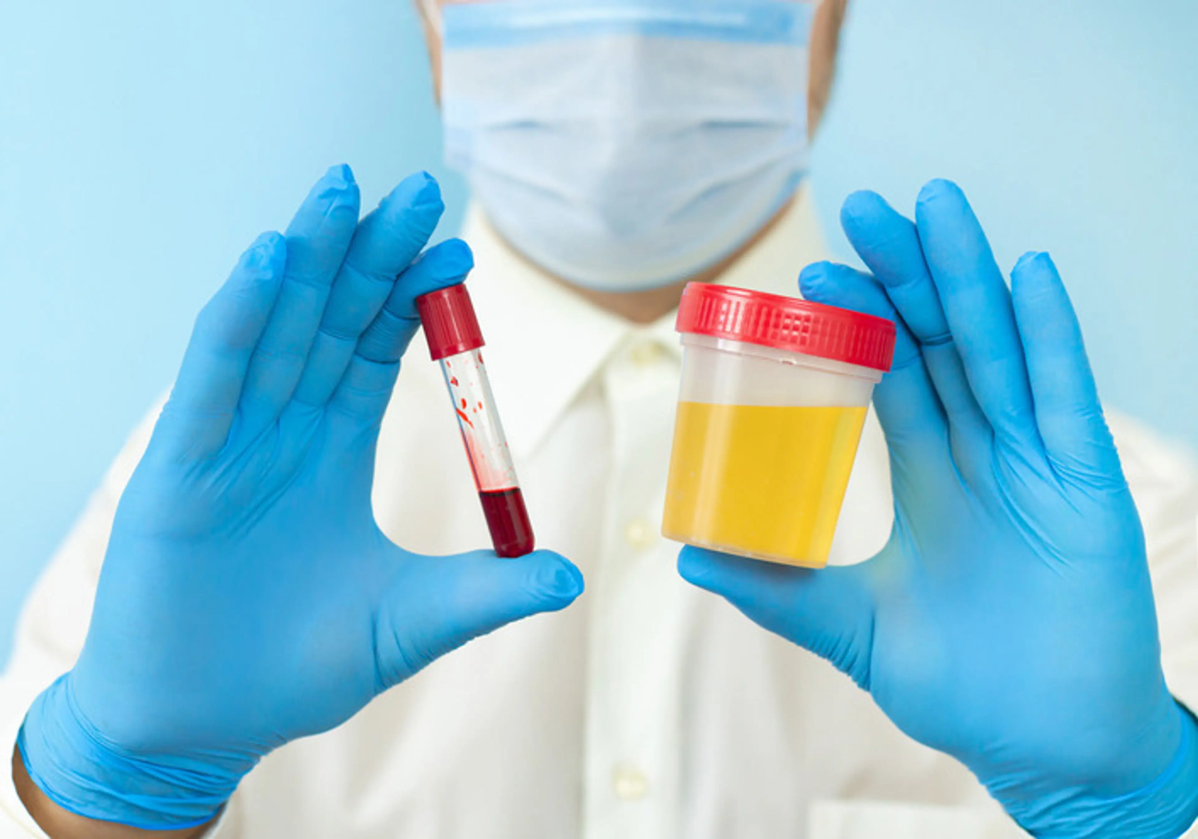 Blood in Urine