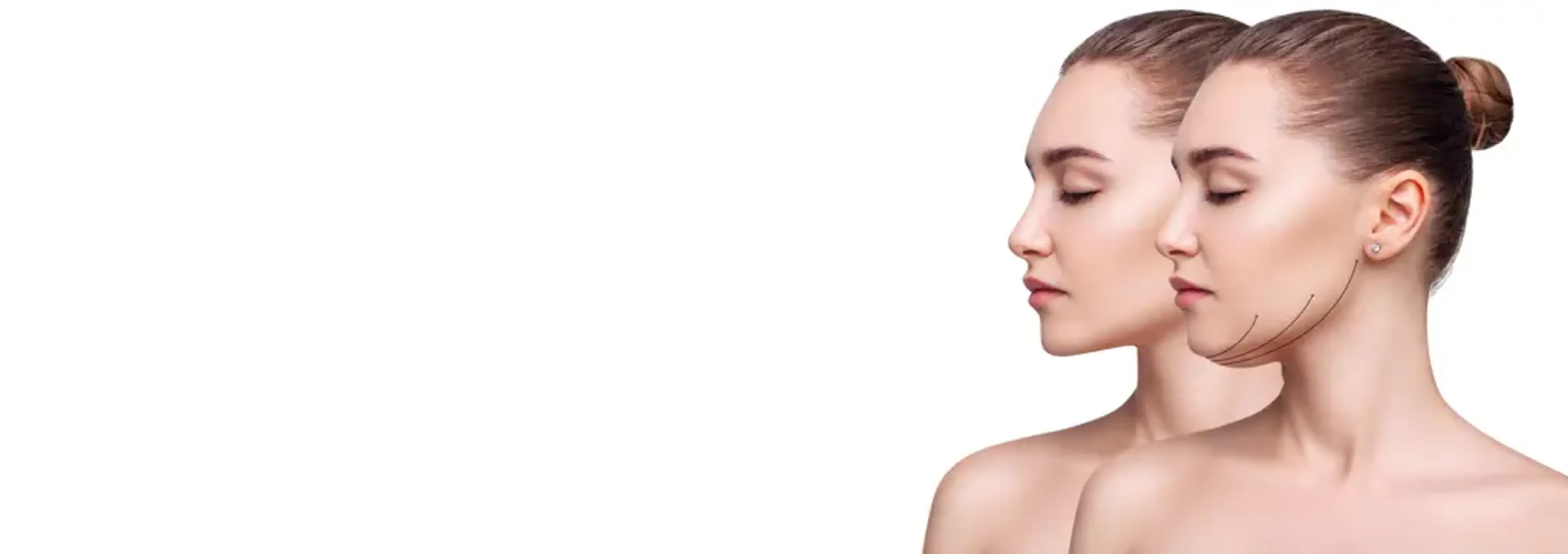 1mm Plastic Surgery