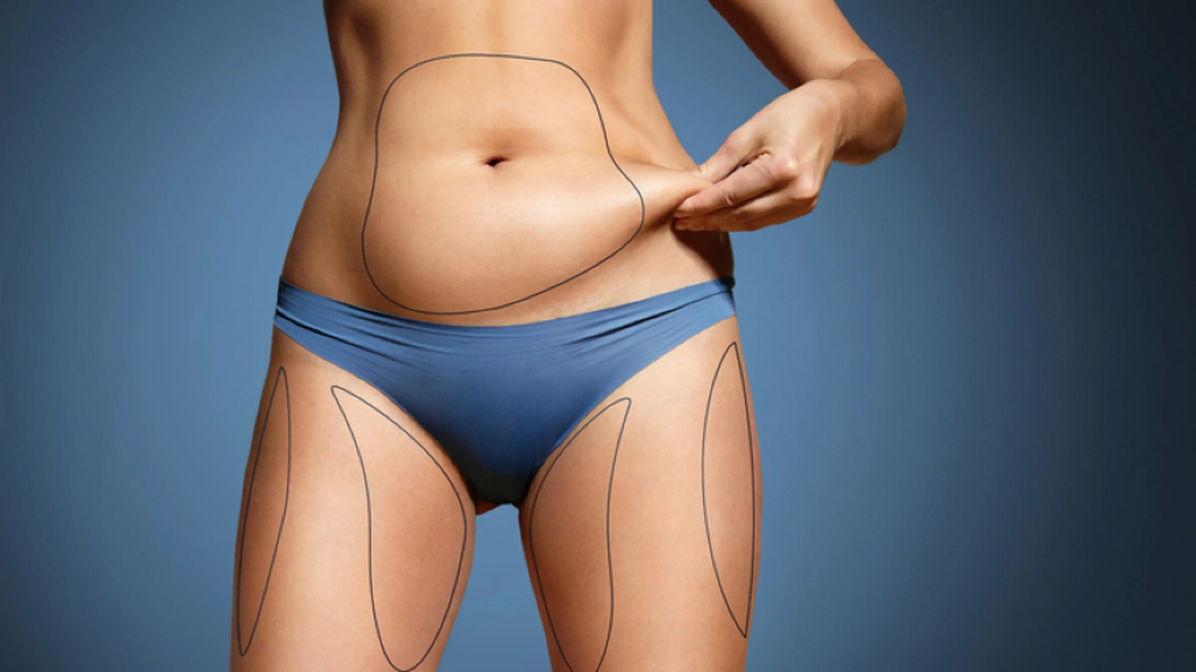 revision liposuction