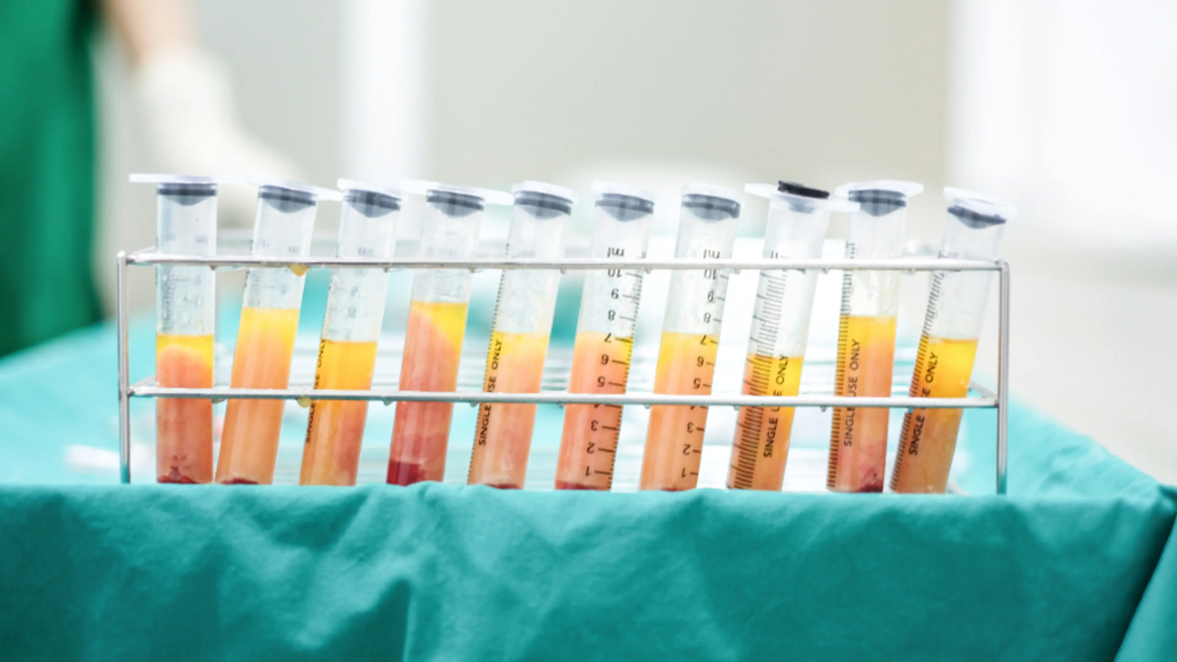 为什么脂肪移植是解决面部容积流失的长期方案