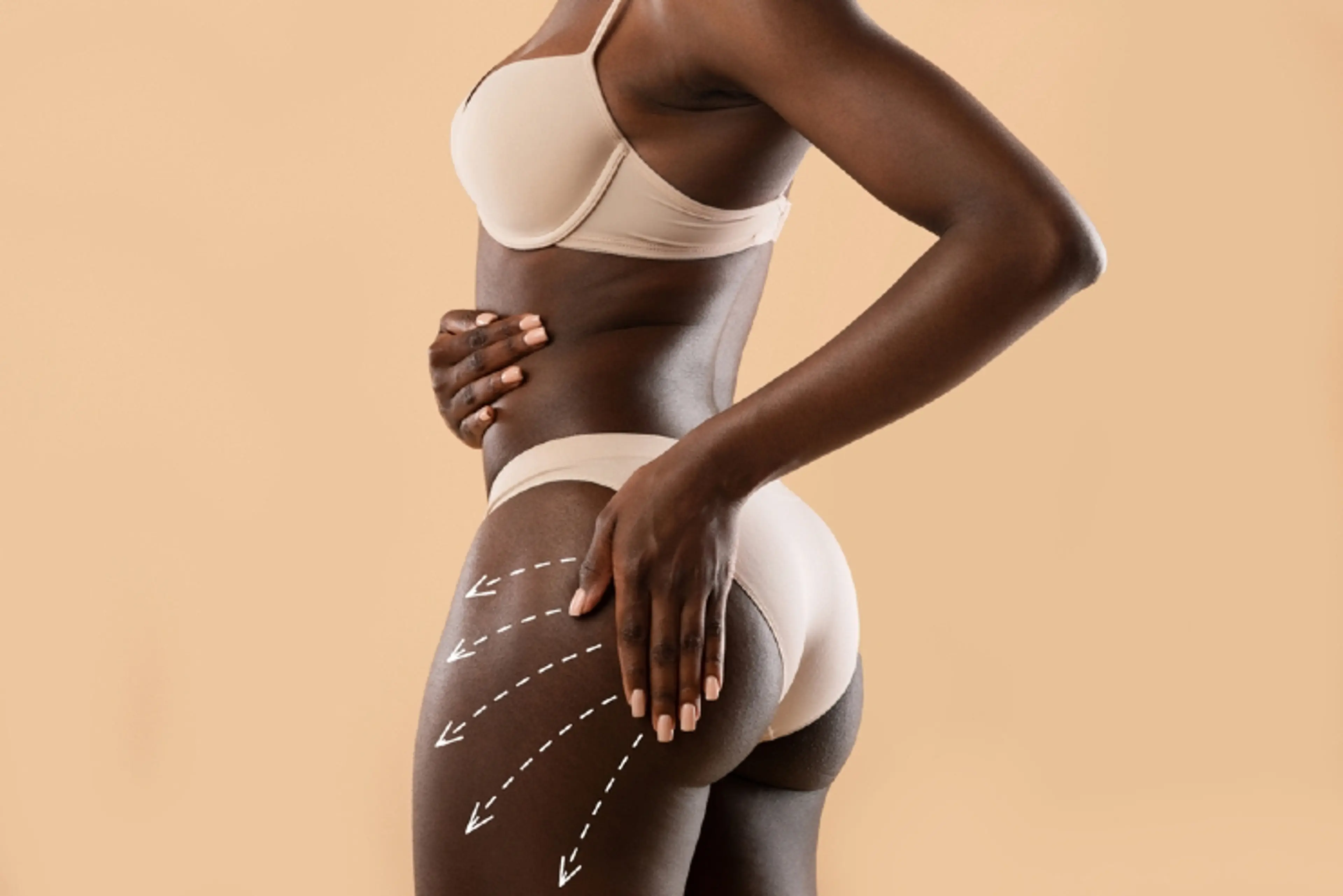 臀部提升手术后的恢复时间