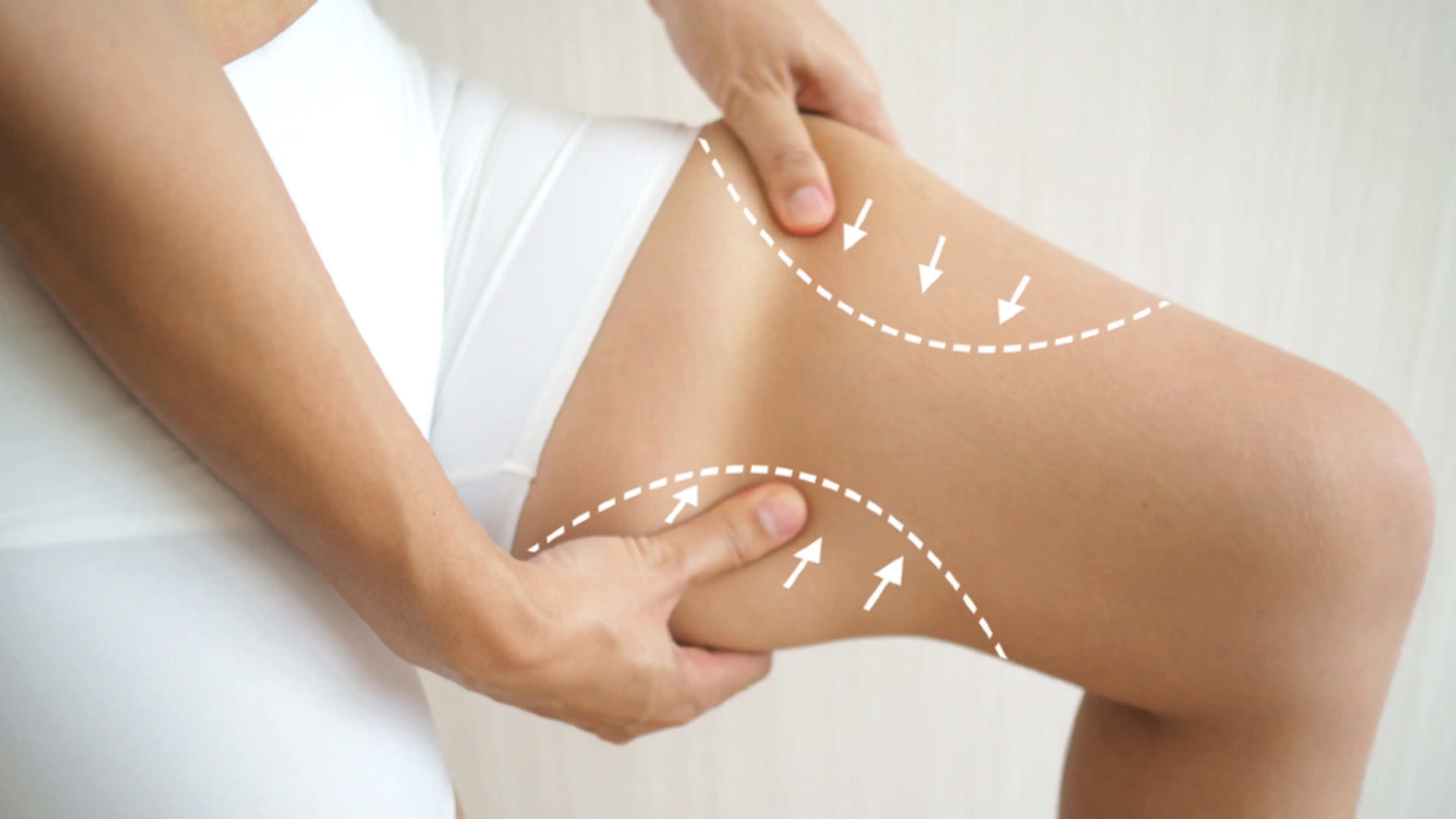 Thigh lipo recovery