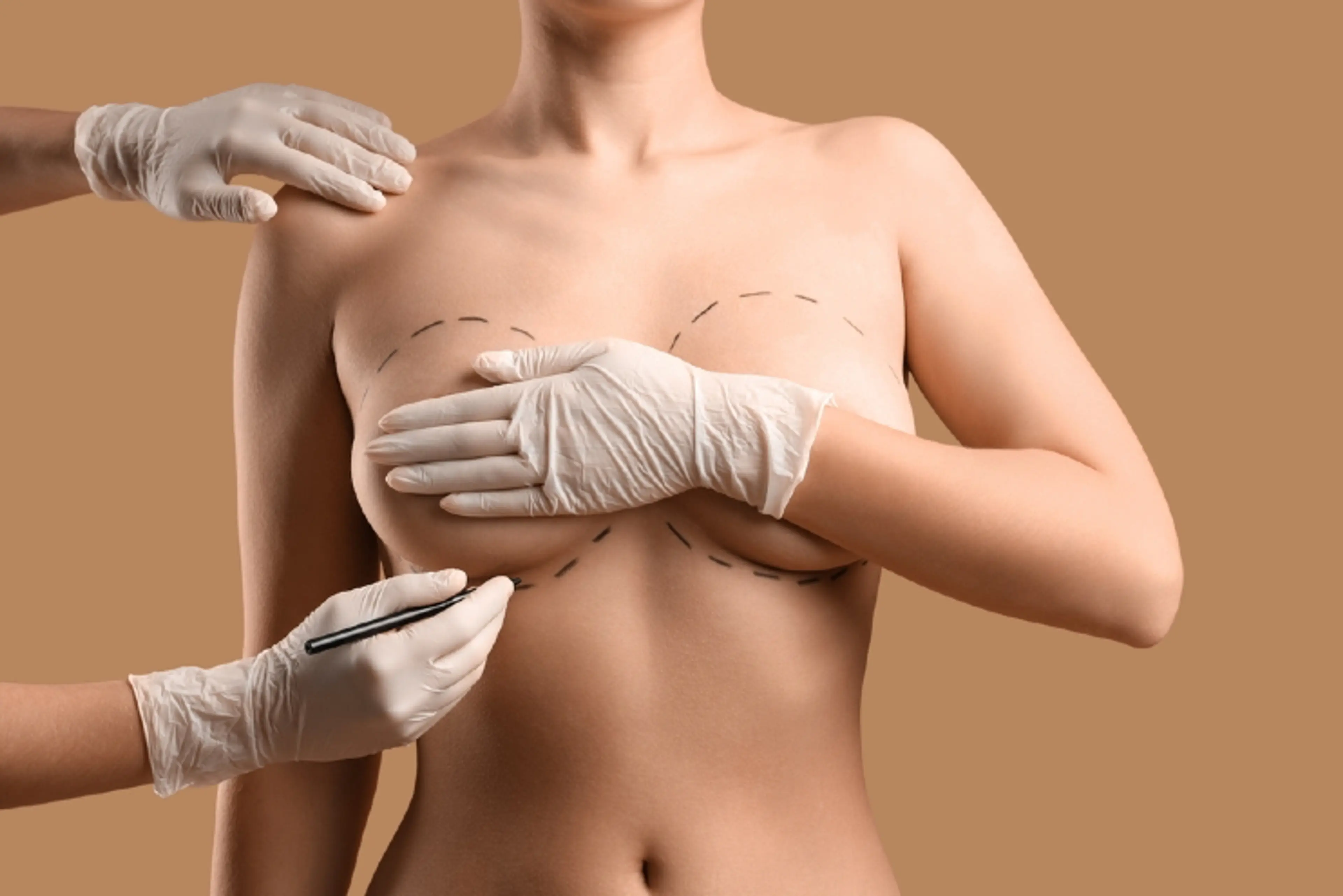 Hybrid Breast Surgery