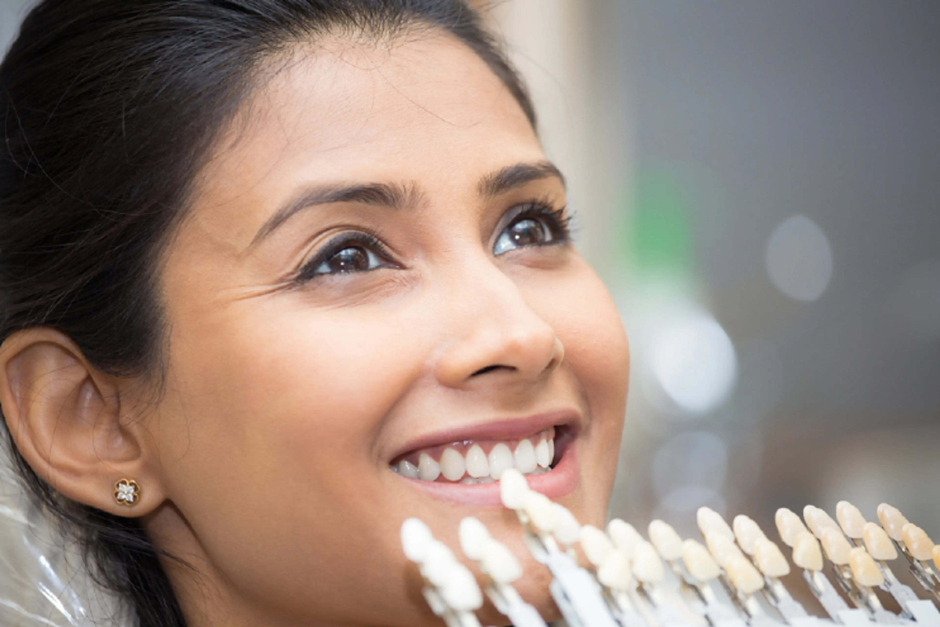 How Dentists Match Crown Shades Perfectly