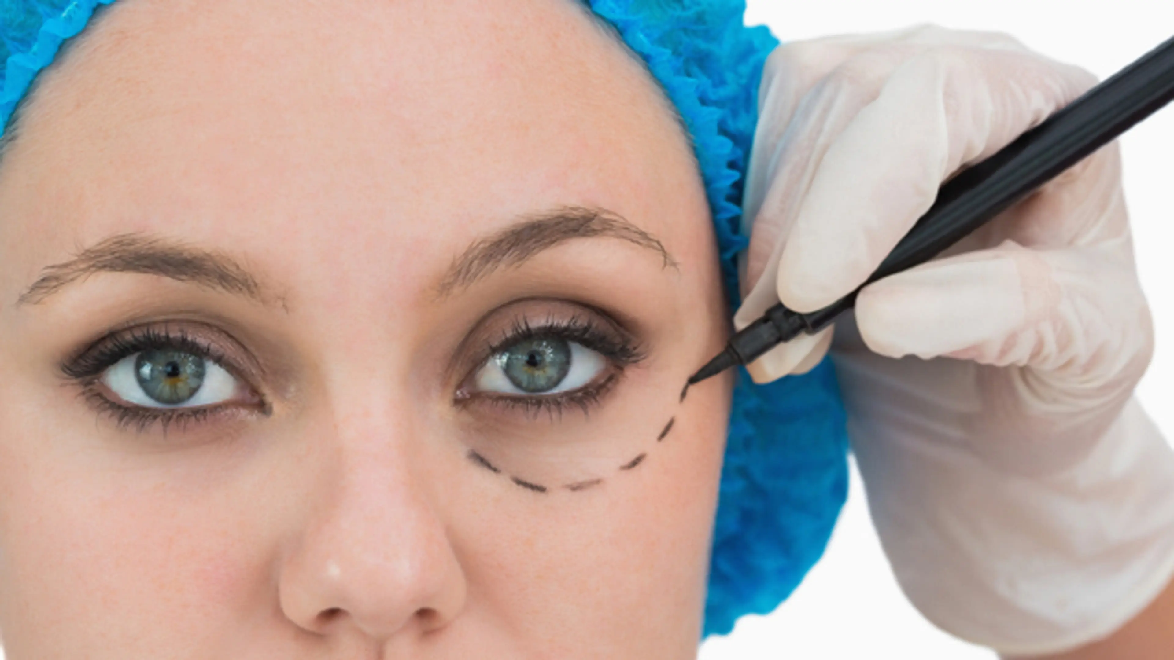 Eye Surgery