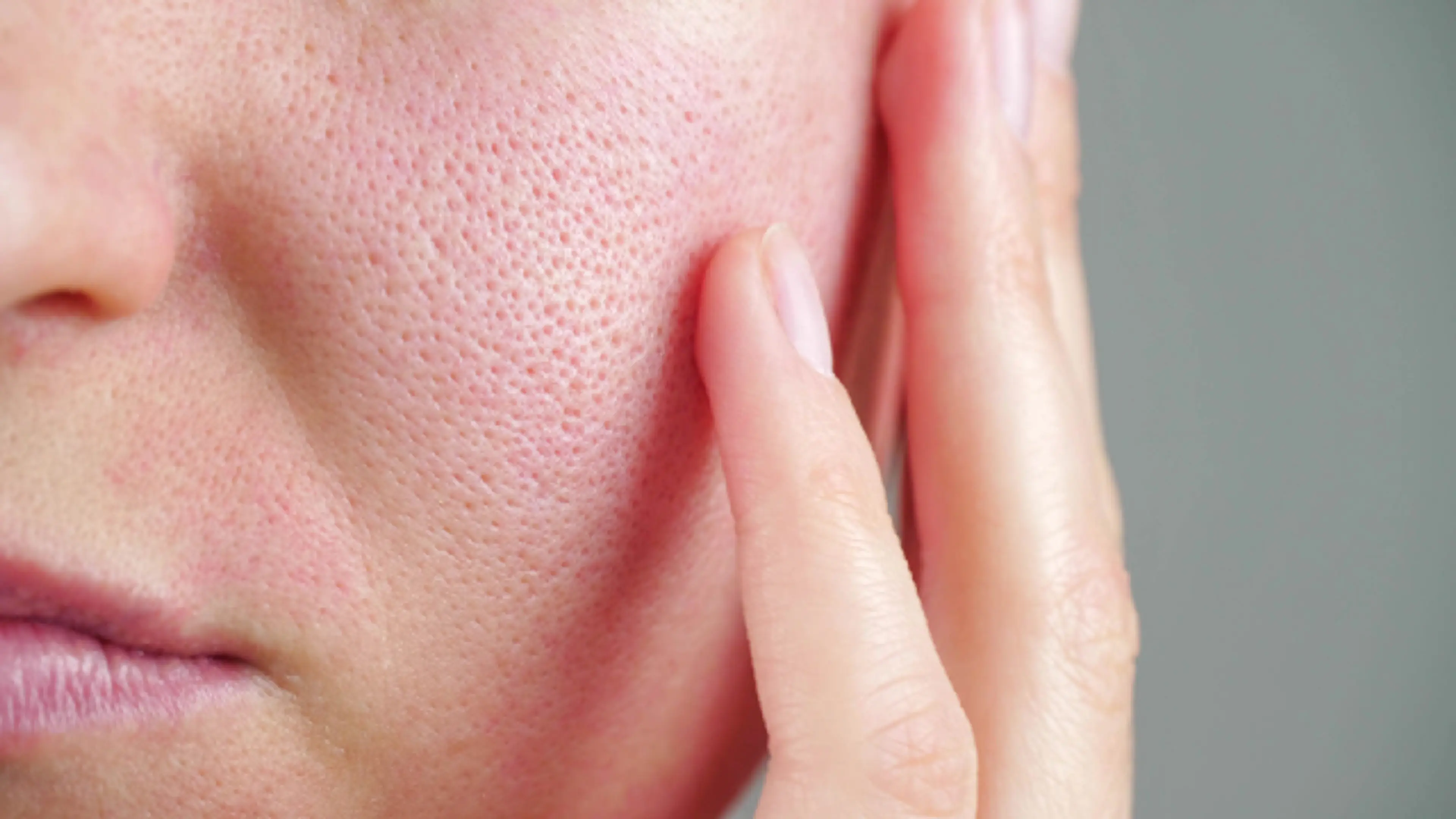 Pores.