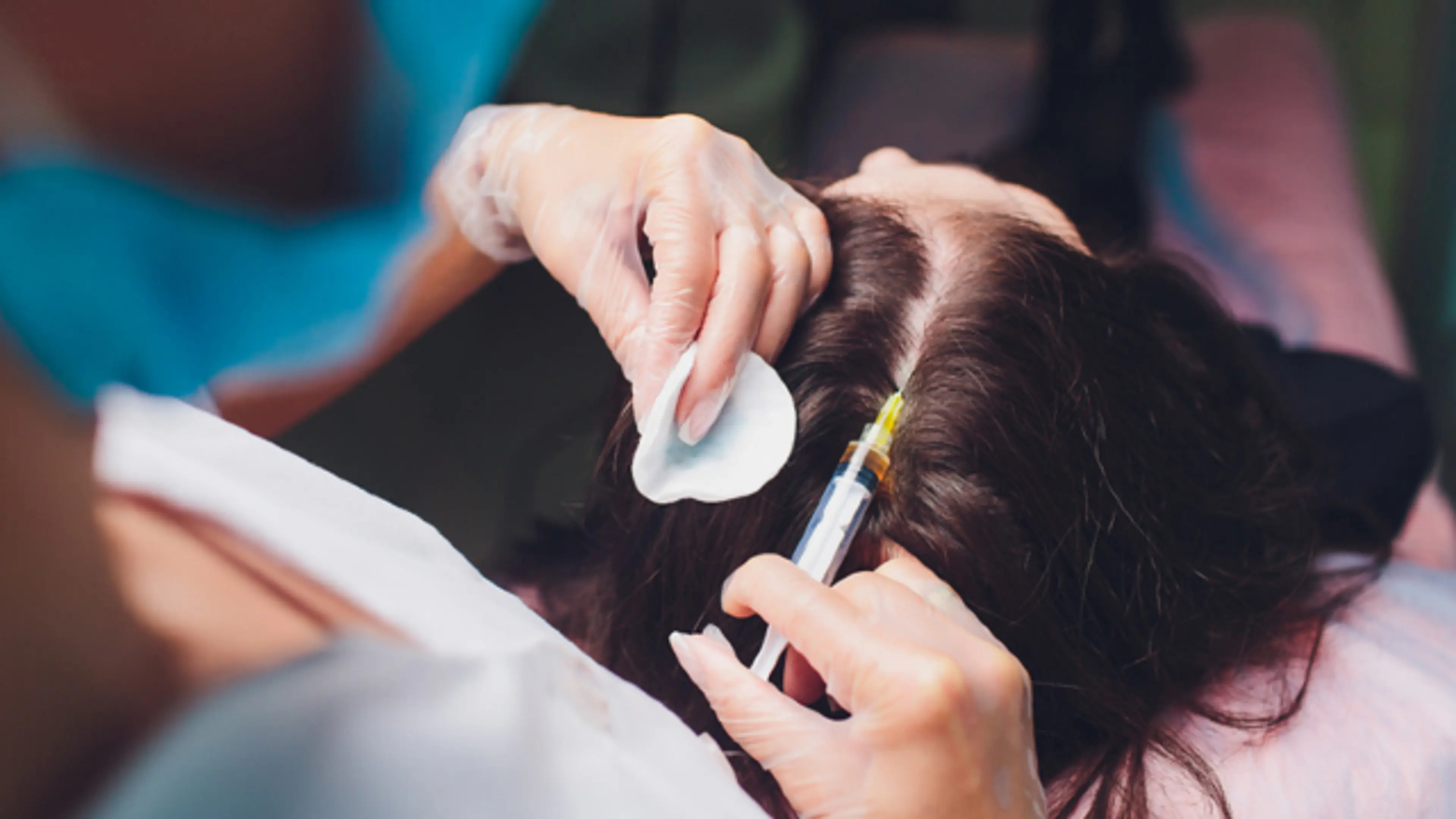Hair Loss Treatment.